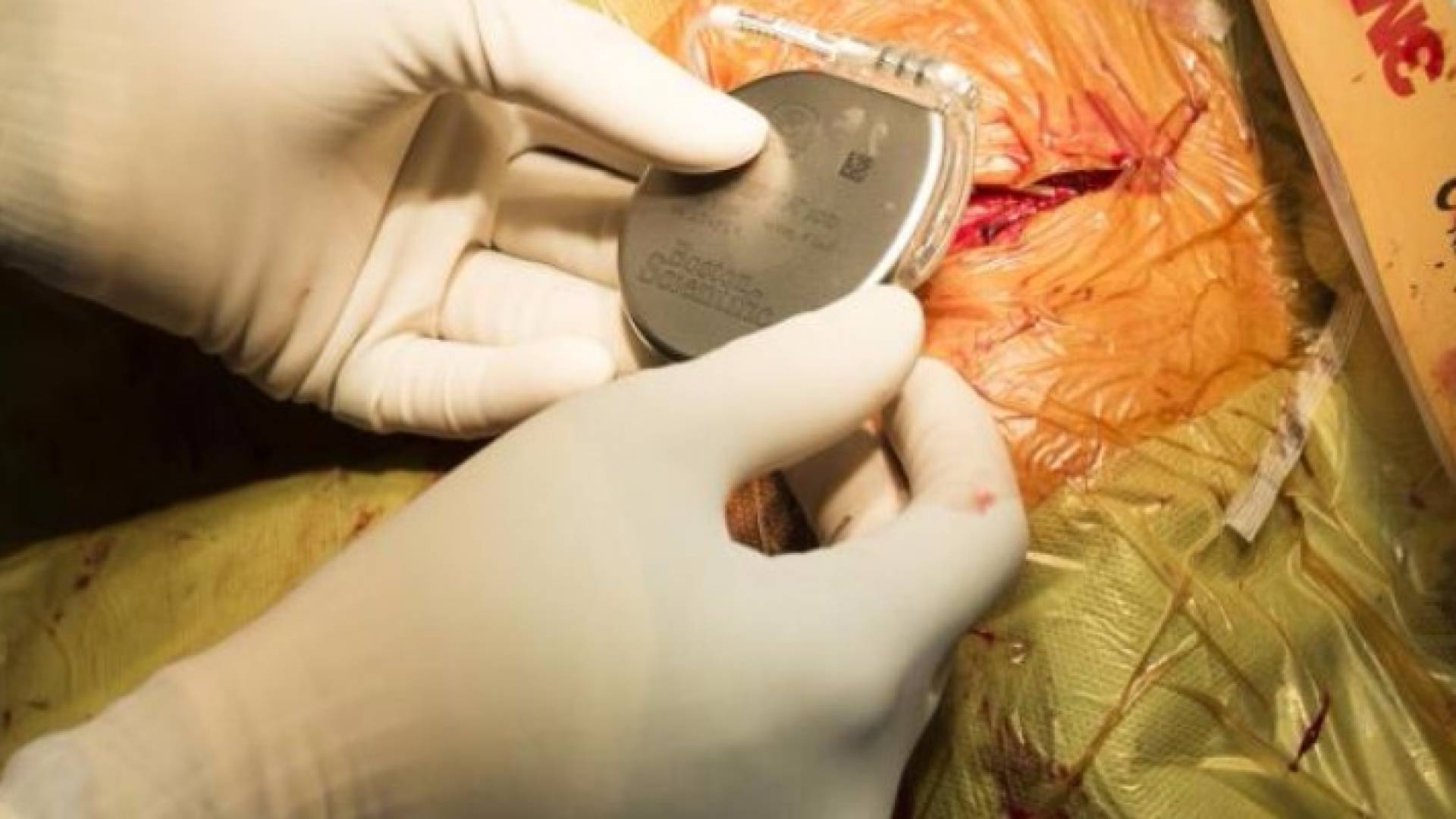 تم تجريب زرع أجهزة إلكترونية في الجسم وثبتت نجاعتها بمعالجة أعراض بعض الأمراض