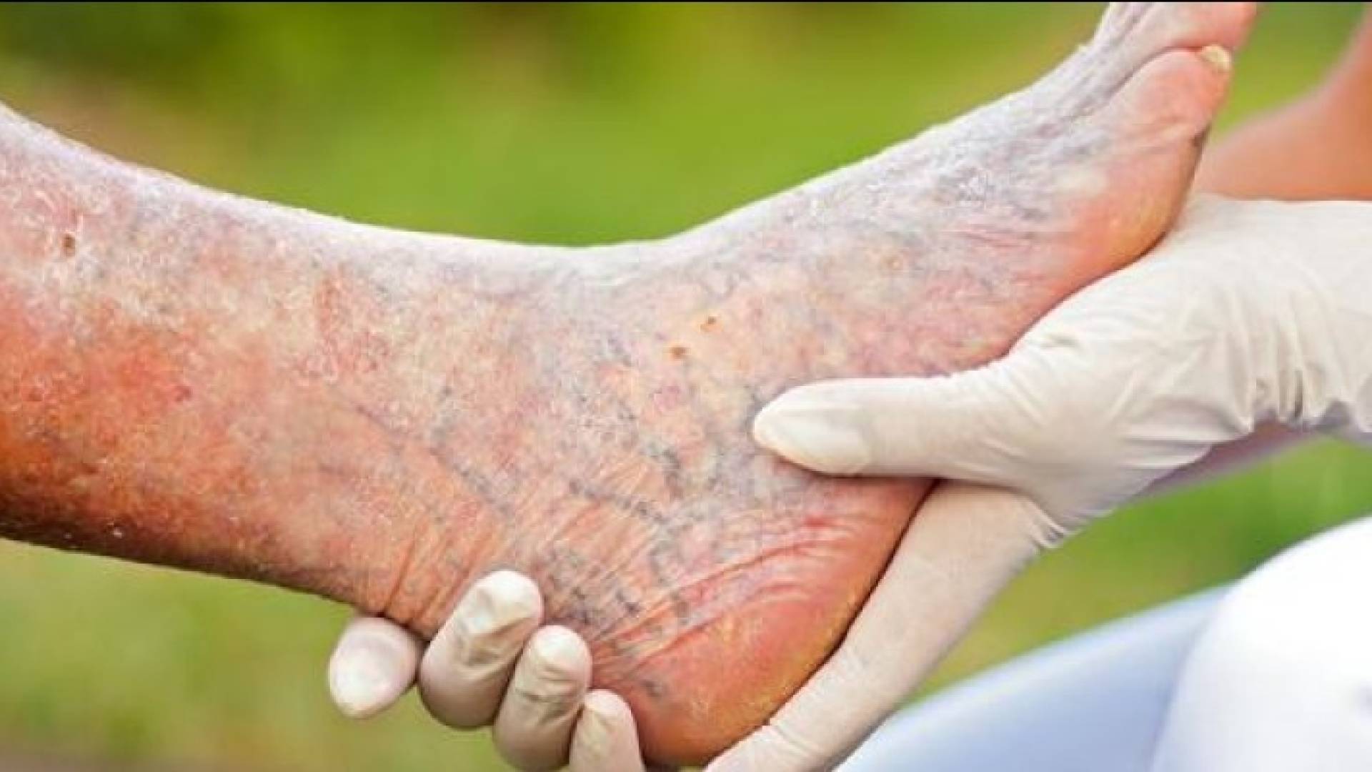 الصورة تعبيرية 