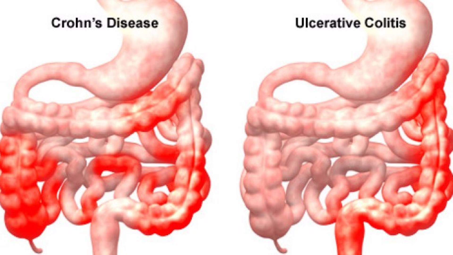 صورة توضيحية 