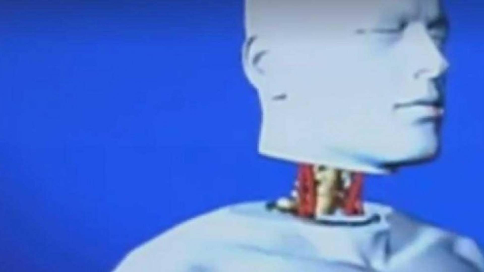 تصور عن العملية