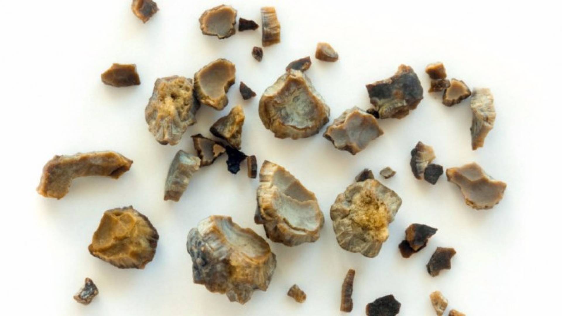 حصى - ارشيفية