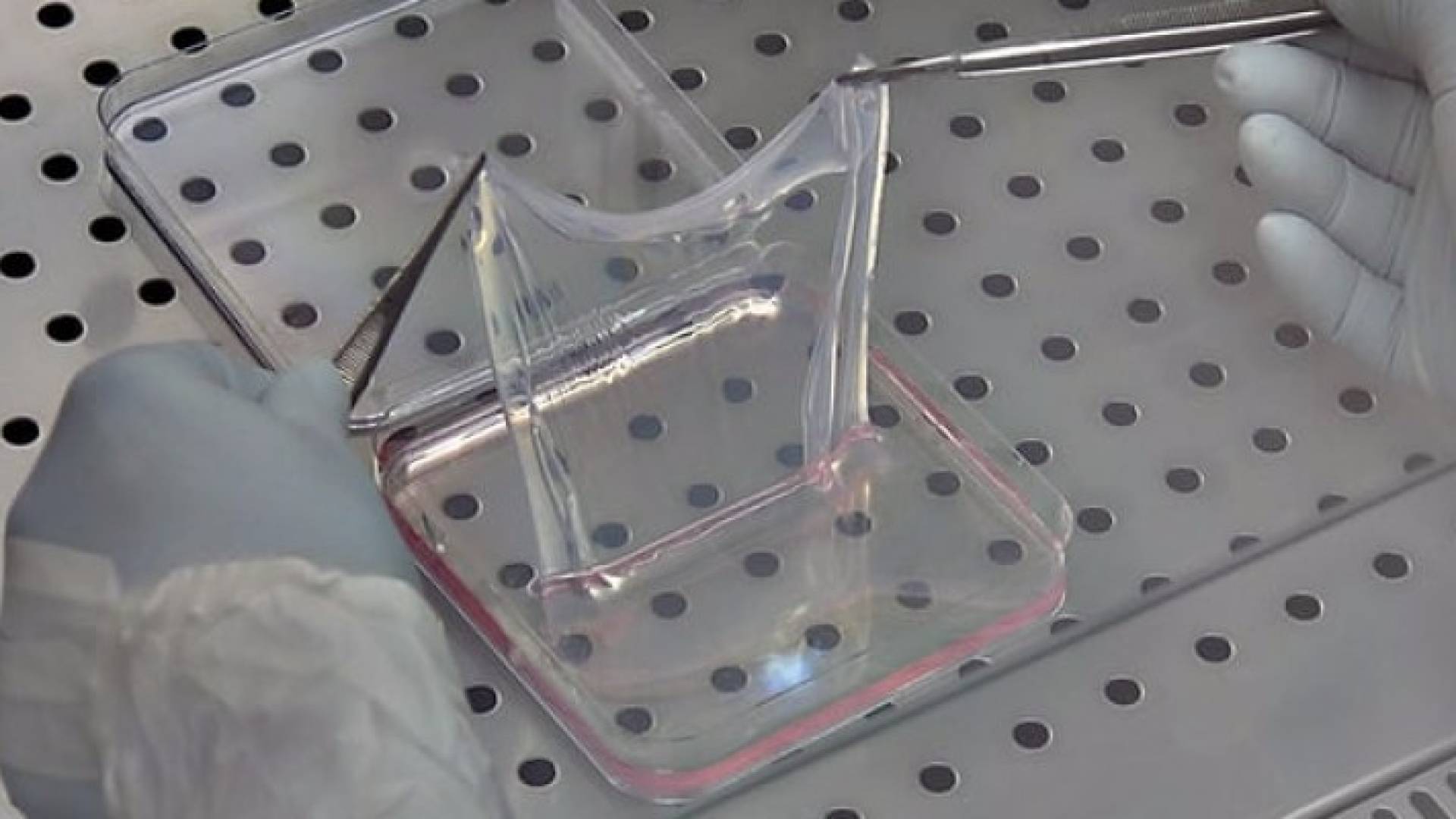 استغرق علاج الطفل حوالي عامين