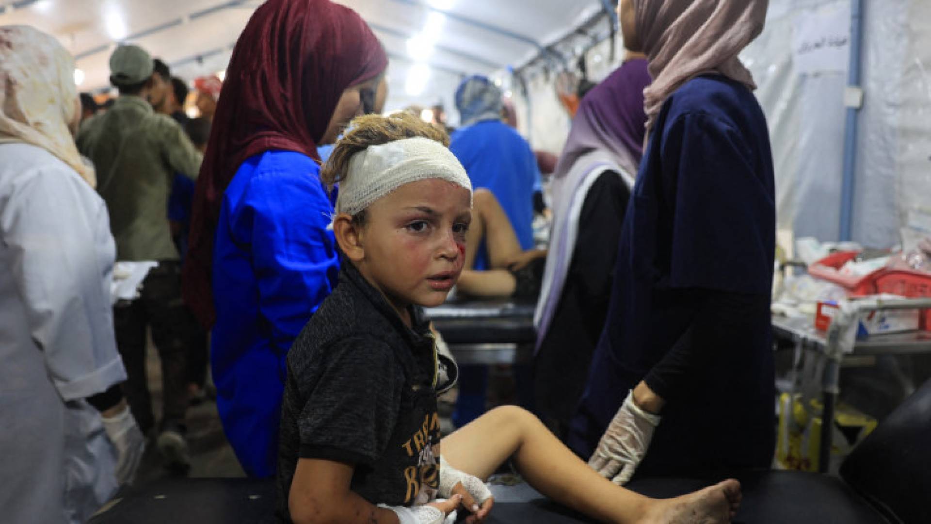 طفل فلسطيني جريح يتلقى العلاج في مستشفى العودة في مخيم النصيرات