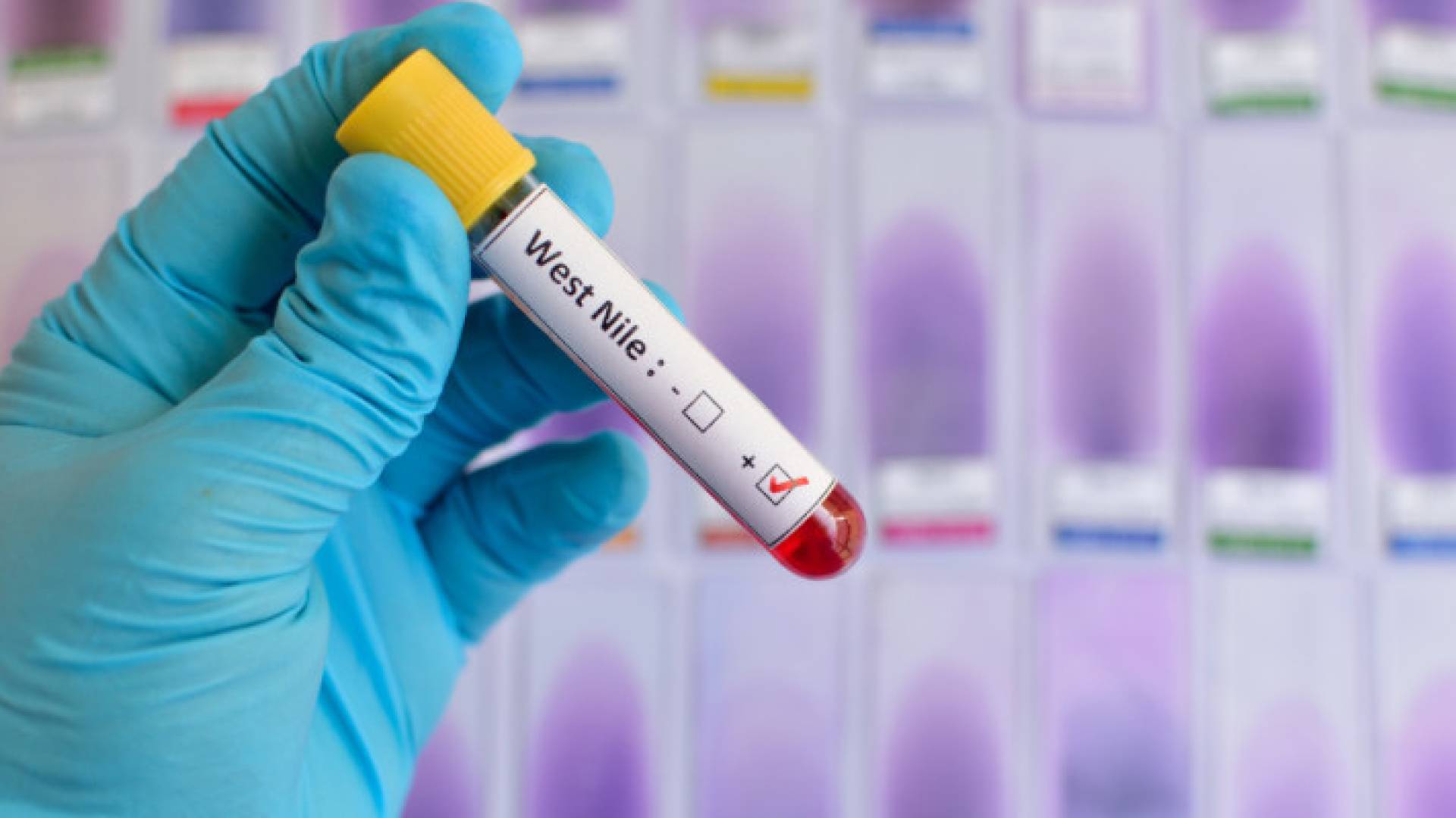 عينة فحص حمى غرب النيل