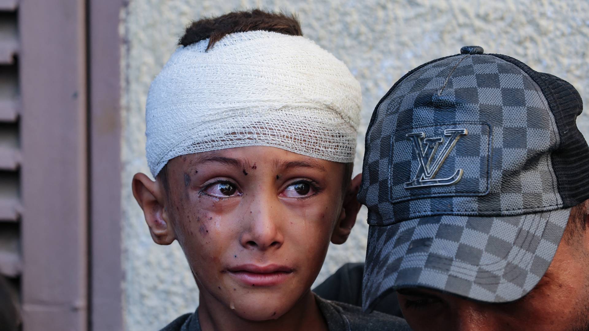 طفل جريح يبكي في ساحة مستشفى شهداء الأقصى في دير البلح وسط قطاع غزة، في أعقاب قصف للاحتلال