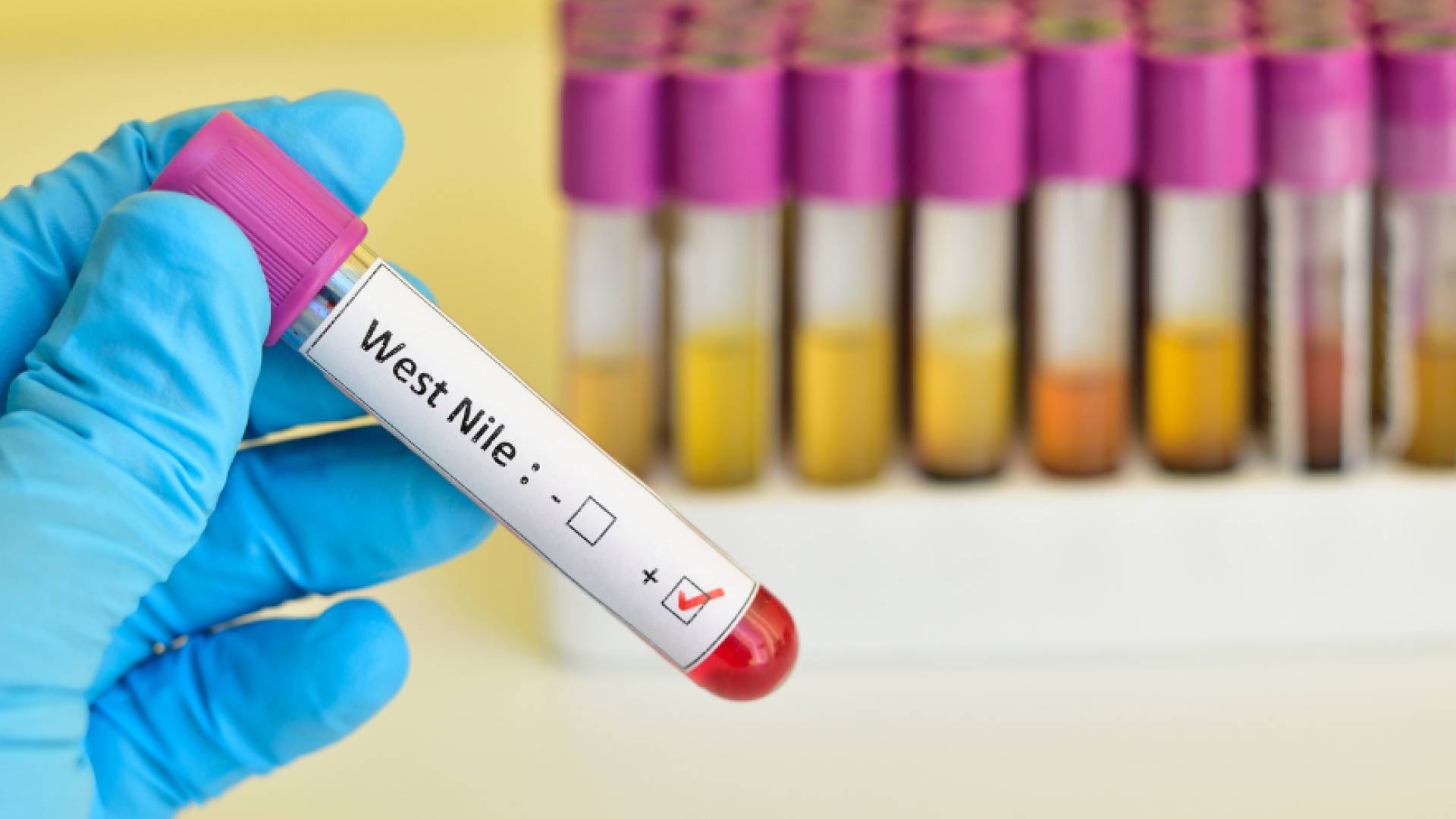 تفاصيل جديدة حول أول إصابة بمرض حمى غرب النيل في الأردن