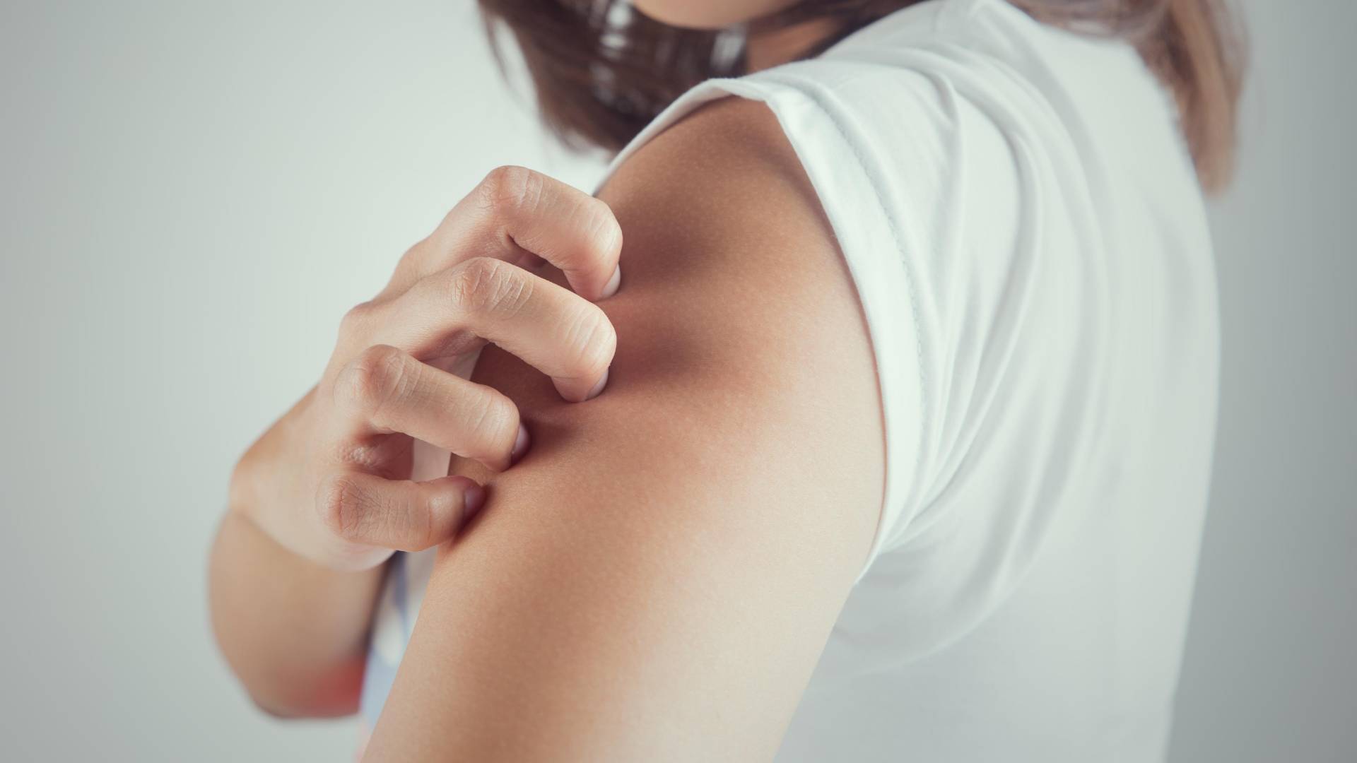 التوتر والقلق يمكن أن يكونا سببا مباشرا للشعور بالحكة