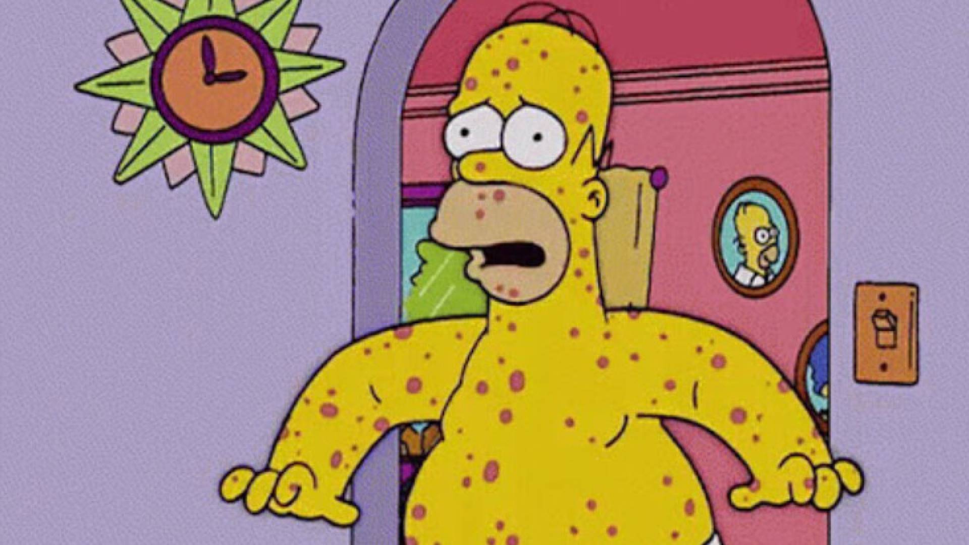 هل تنبأ مسلسل "ذا سيمبسونز" بجدري القرود؟