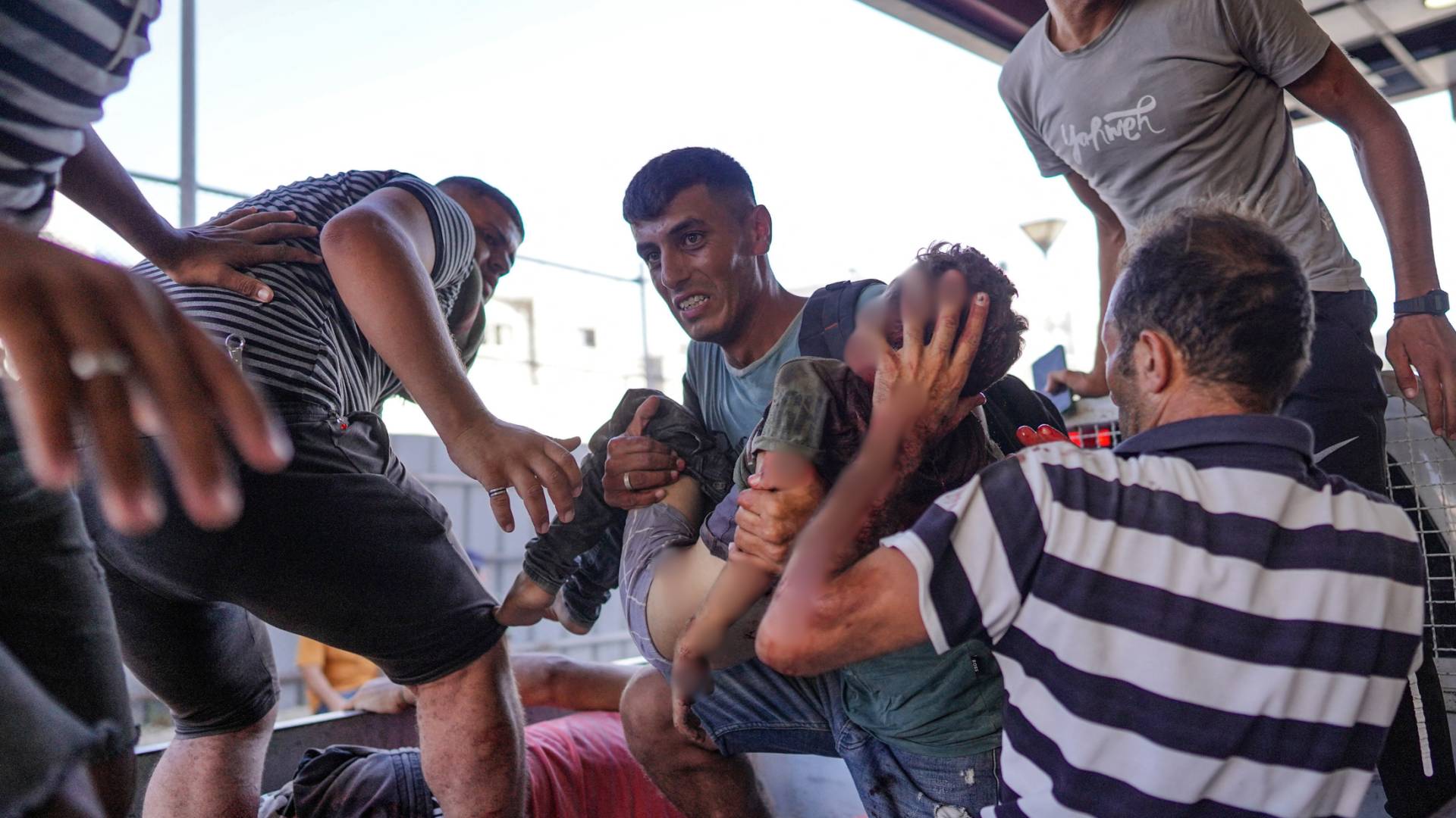 فلسطينيون يحملون صغيرا مصاباً في ضربة للاحتلال إلى مجمع ناصر الطبي في خان يونس