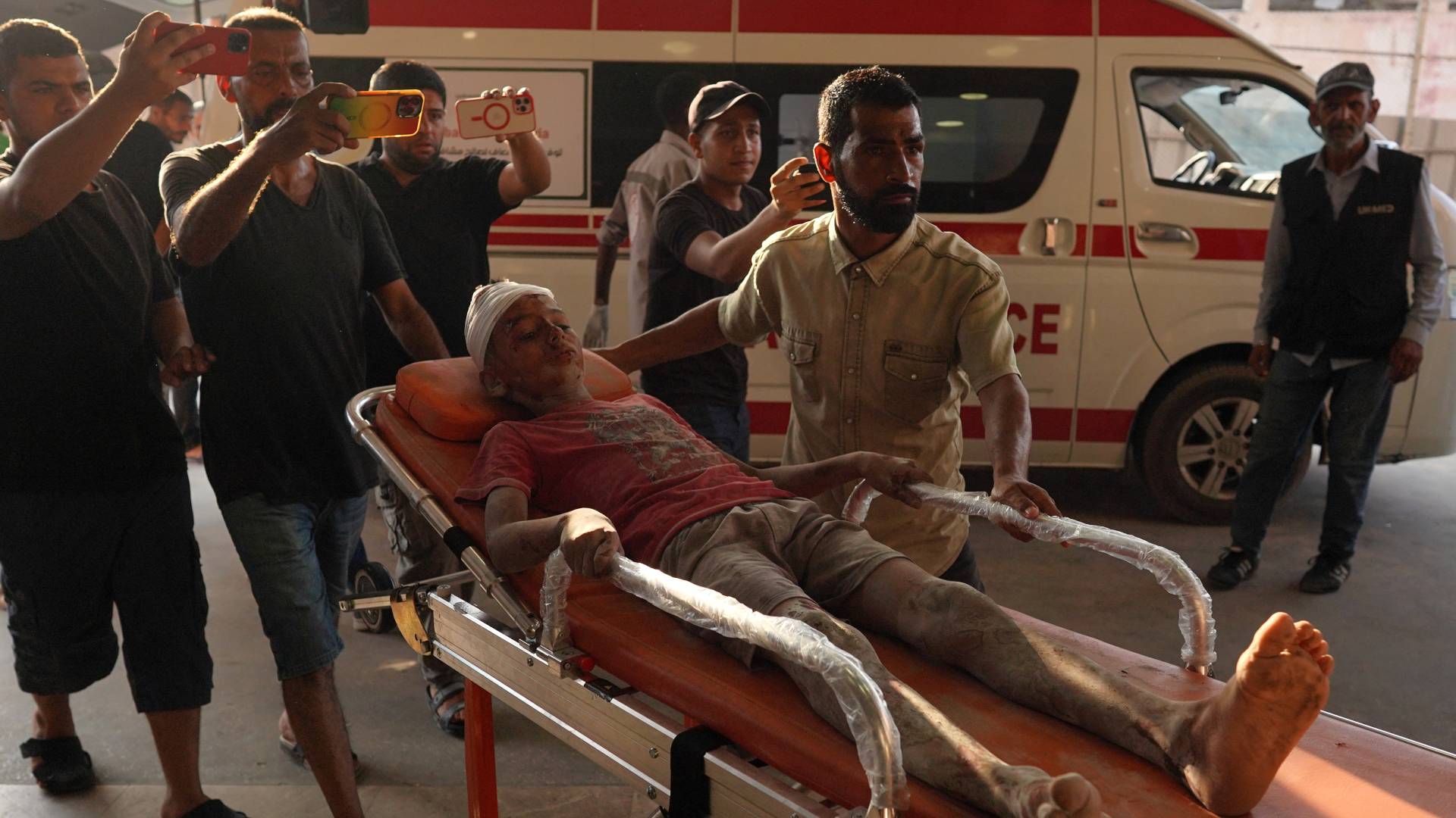 فتى فلسطيني جريح في مستشفى ناصر