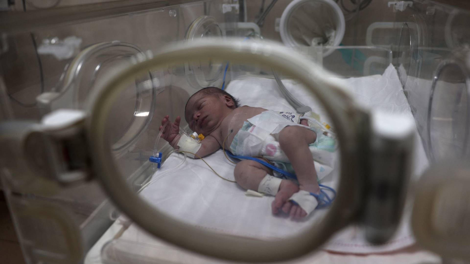 طفل فلسطيني يتلقى الرعاية في حاضنة