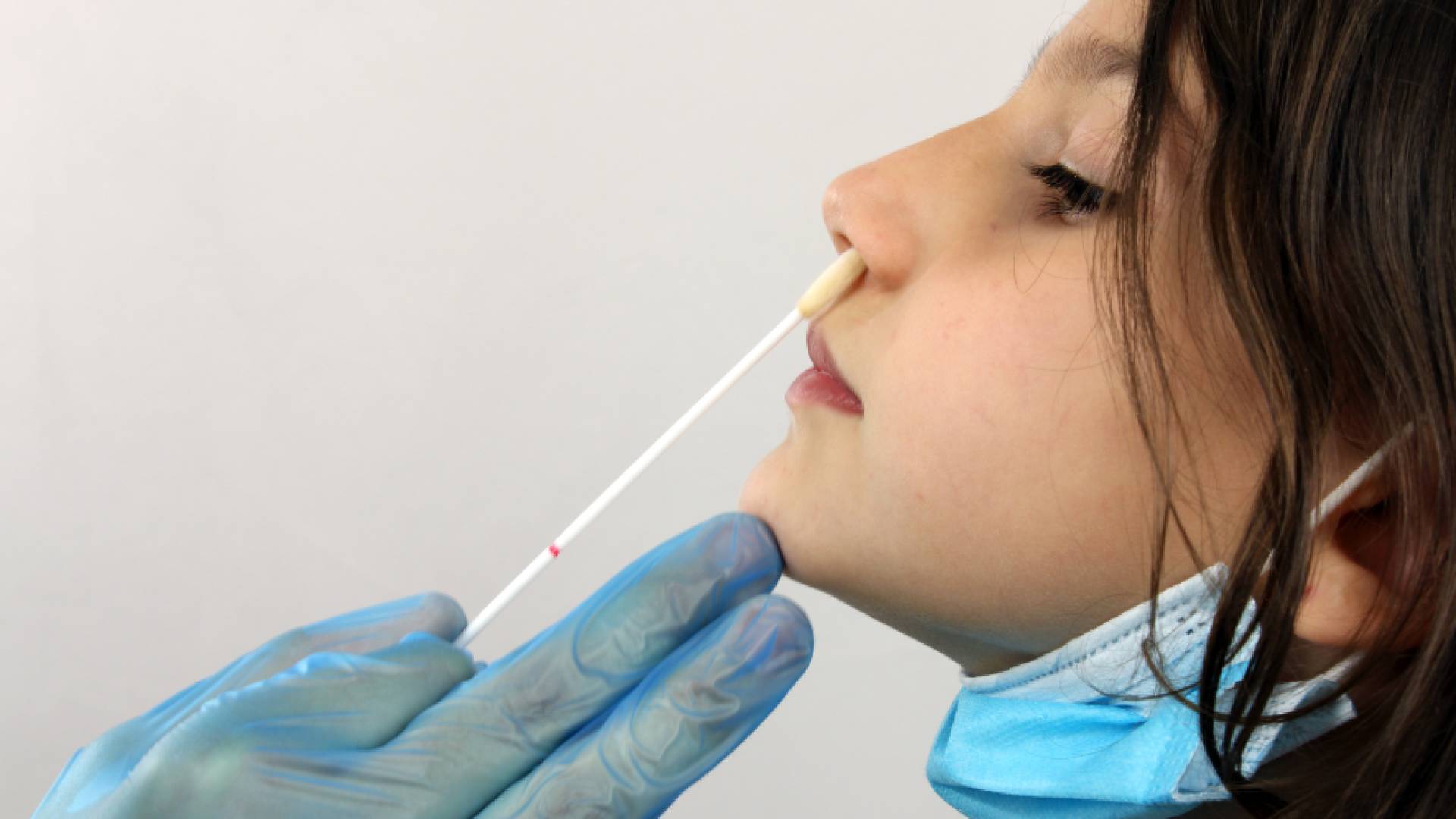 جدري القرود.. توضيح رسمي حول عودة فحوصات "PCR" للقادمين إلى الأردن