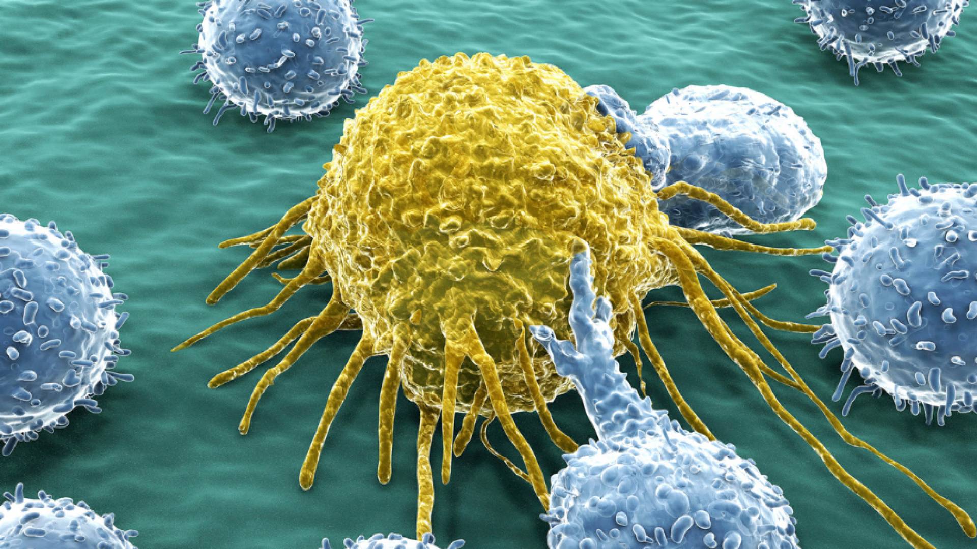 تجارب لقاح جديد للسرطان تمنح الأمل للمرضى