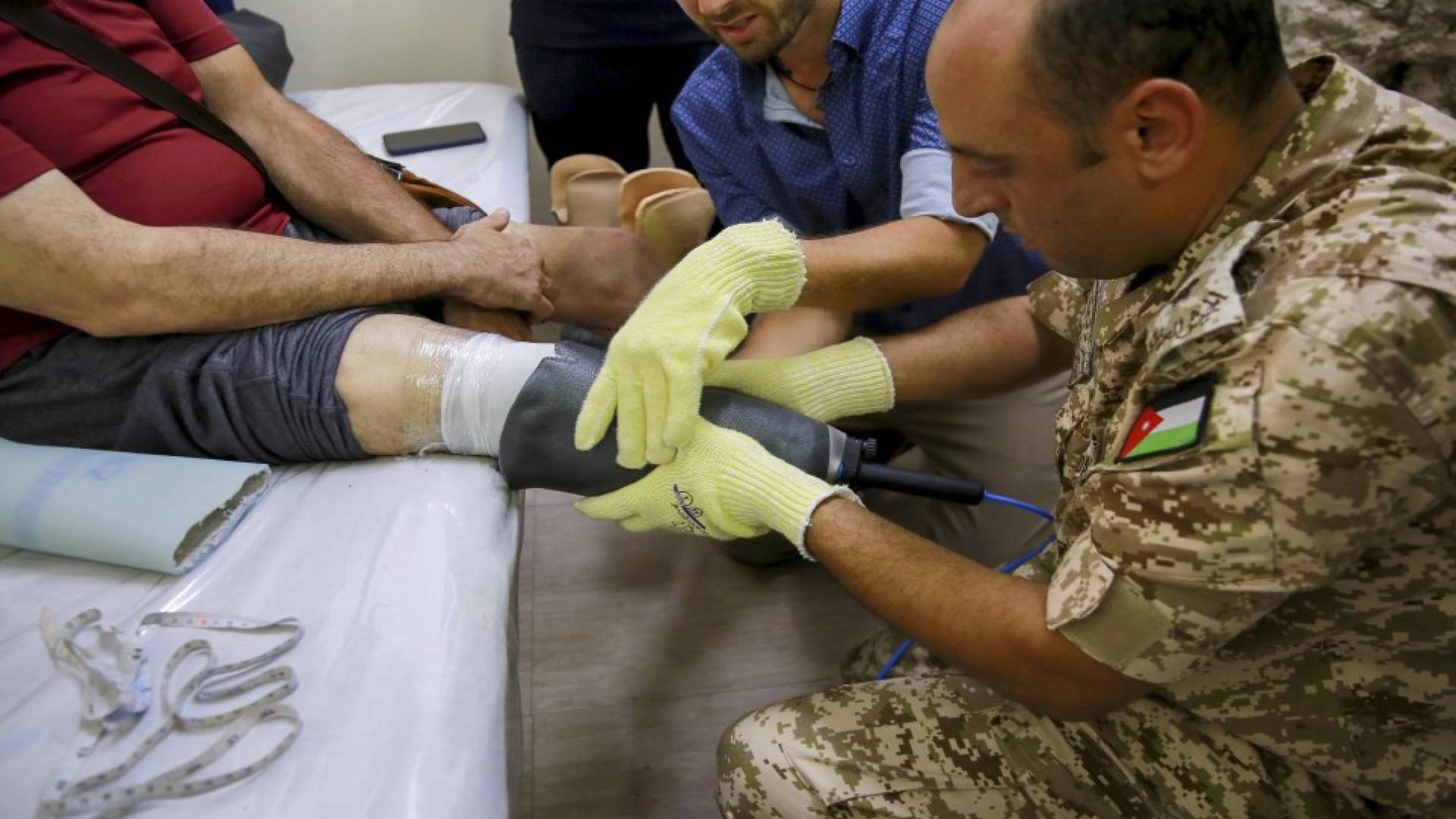 تركيب طرف صناعي لطفل من غزة