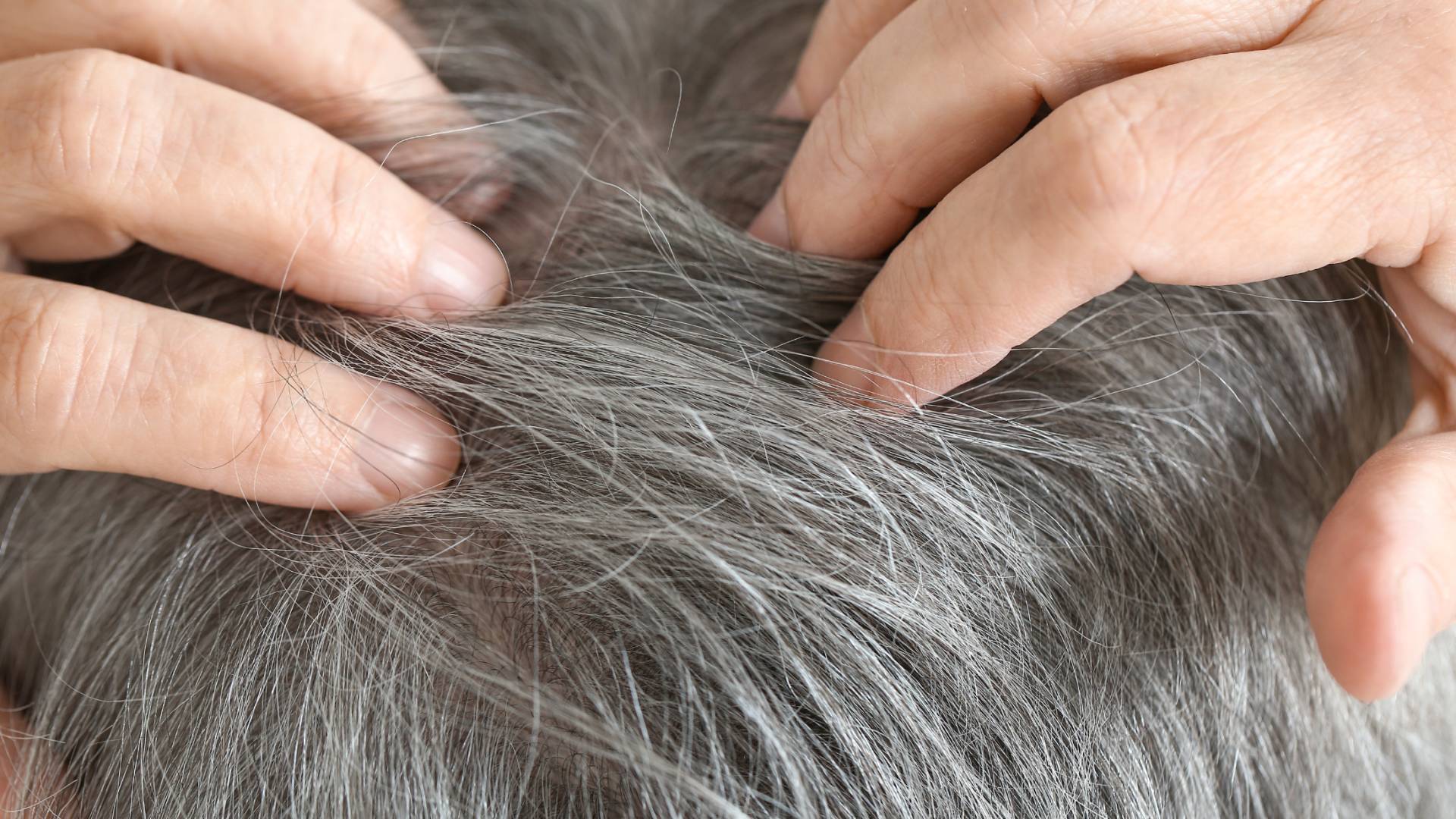 صورة تظهر سيب الشعر