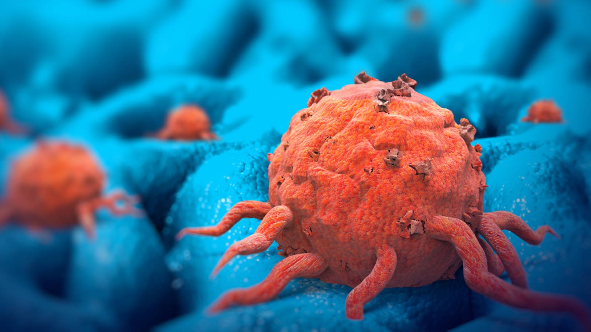 خلايا سرطانية - تعبيرية