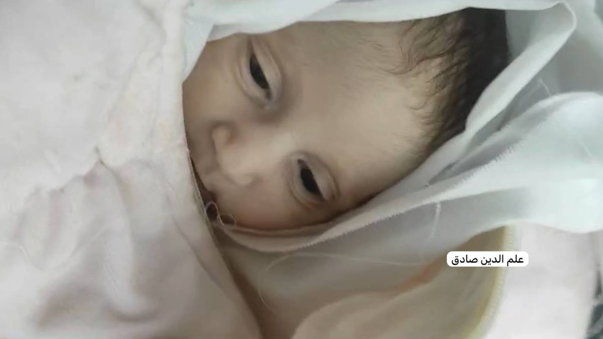 الرضيعة عائشة القصاص شهيدة البرد الشديد في خيام النازحين بغزة