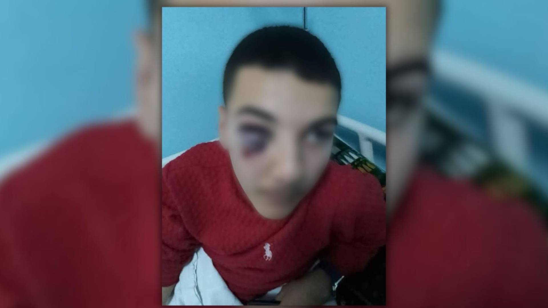 إصابة طالب