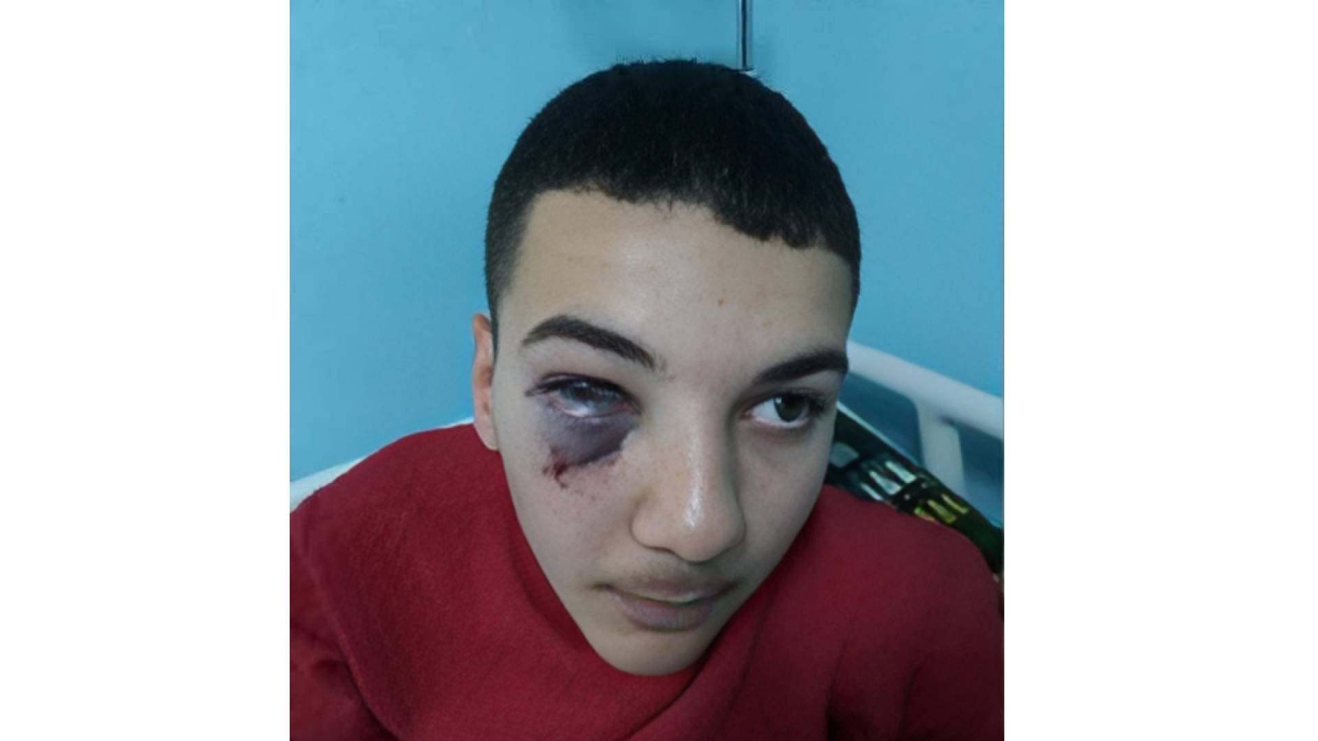 الطالب المعتدى عليه من قبل معلم في عجلون