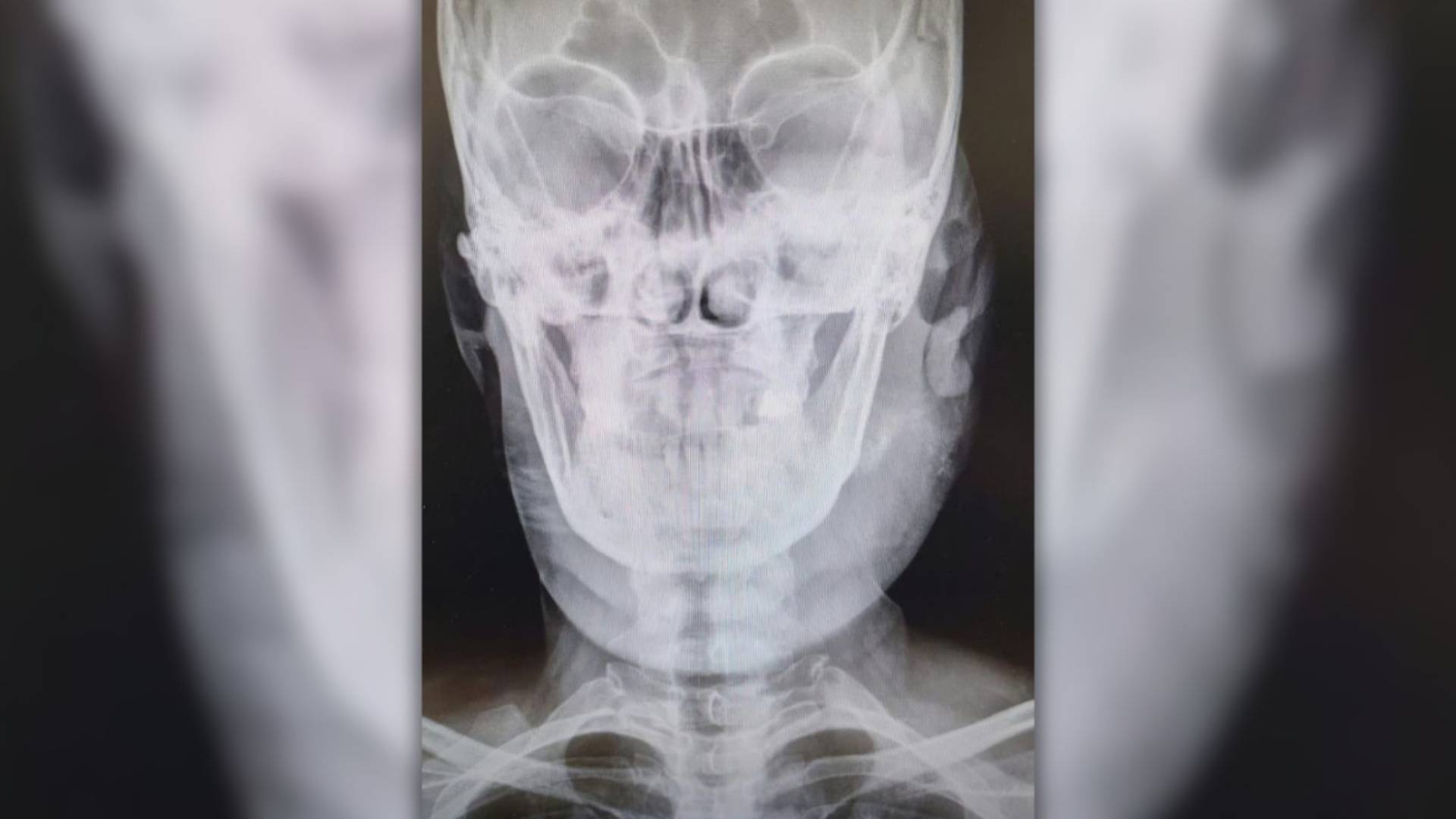 انقاذ سيدة أربعينية