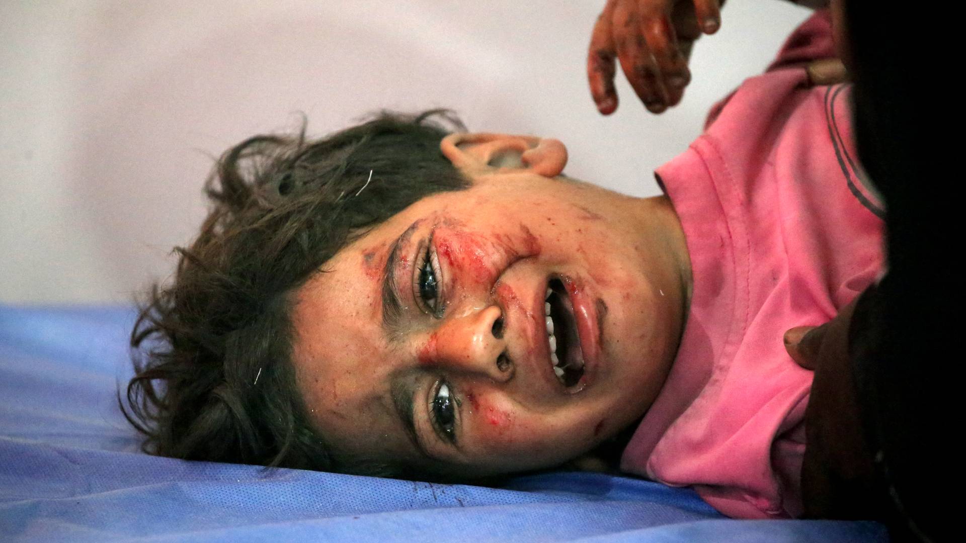 طفلة مصابة في قطاع غزة