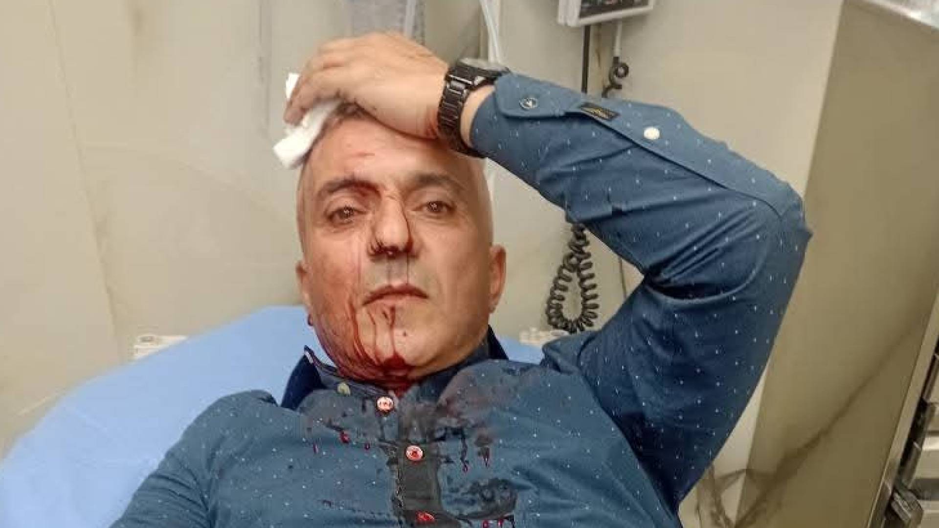 الاعتداء على الصحفي فارس الحباشنة