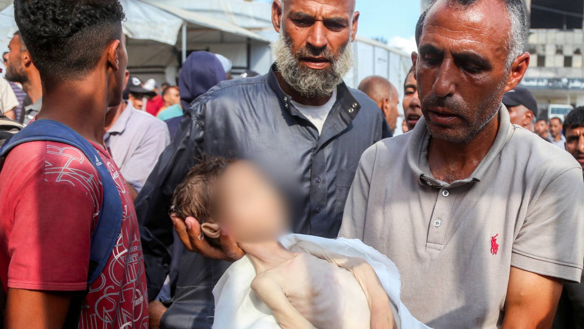 استشهاد طفل جائع في غزة