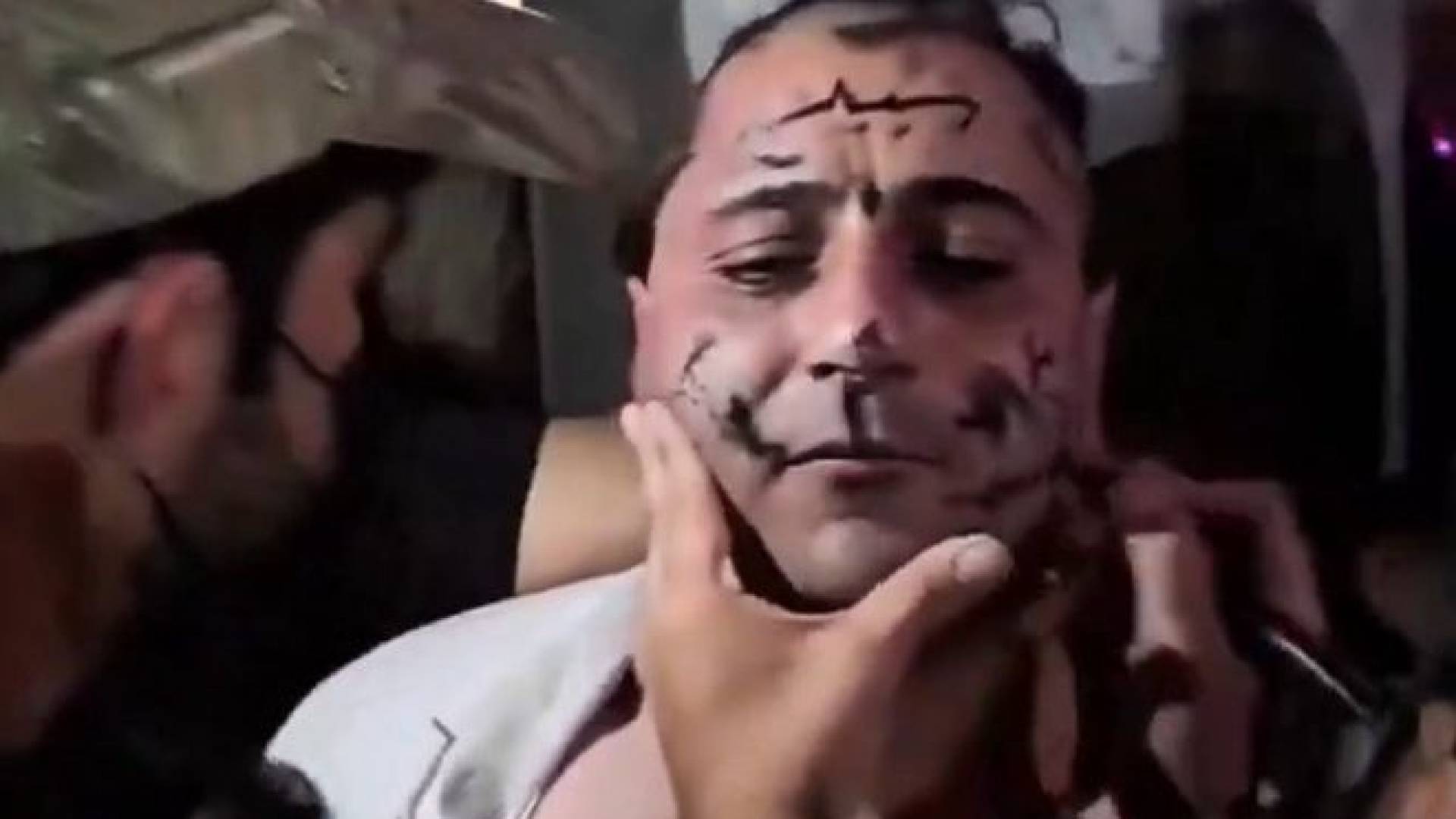 اعتداء على مطرب سوري في حلب