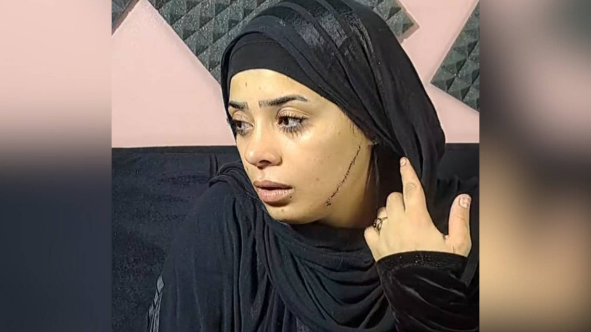 مطلقة تشوه وجه عروس طليقها قبل أيام من زفافها