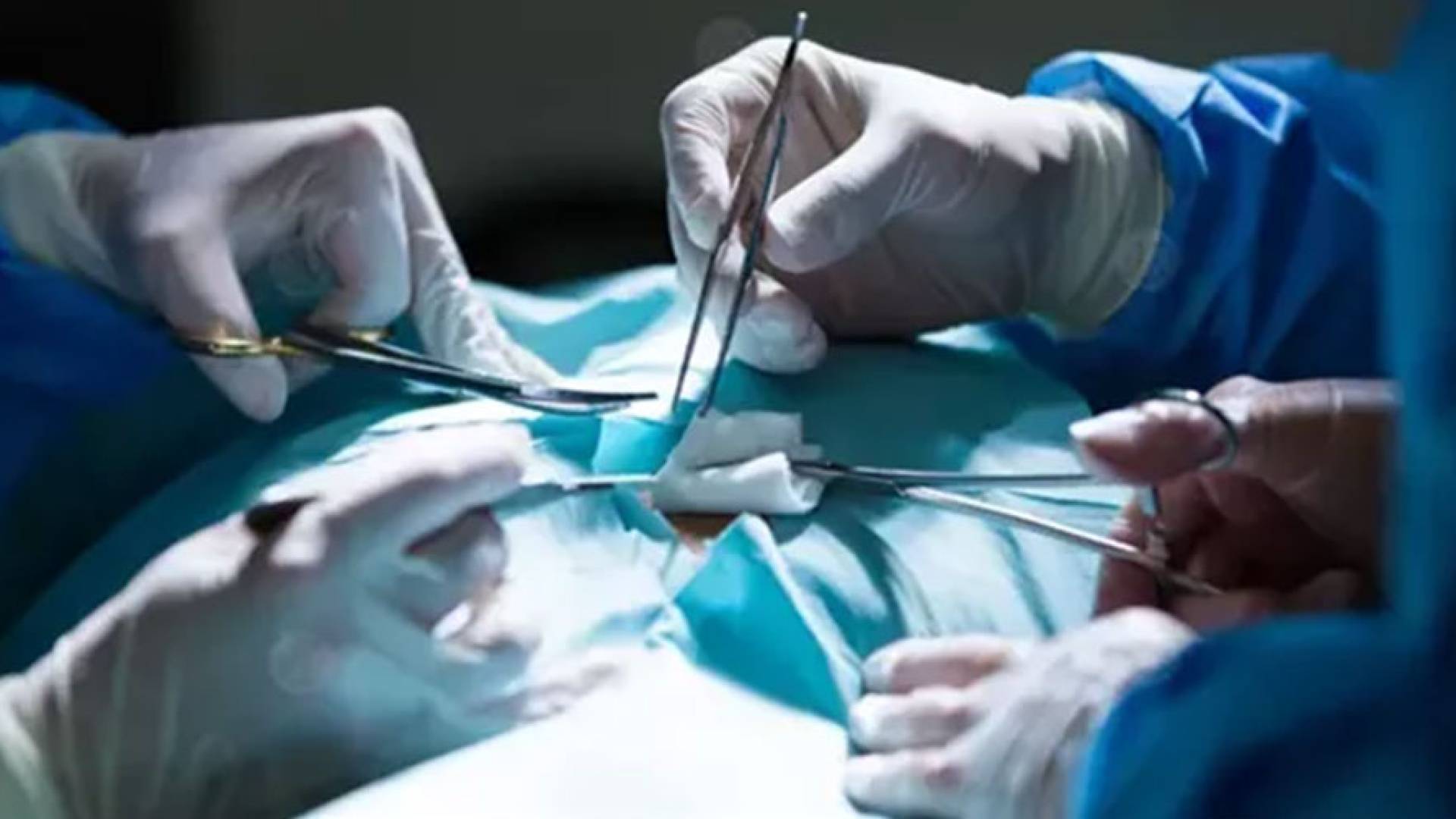 عملية جراحية "تعبيرية"