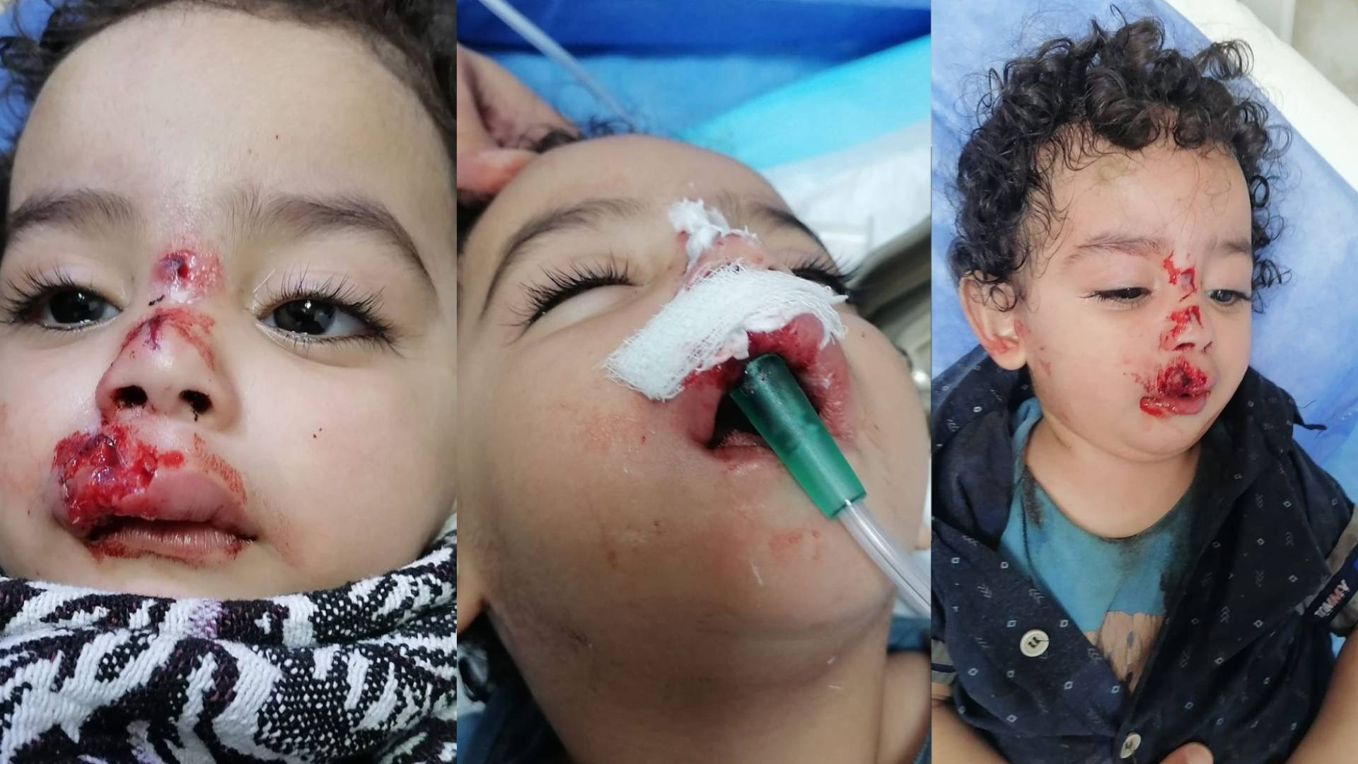 ارشيفية.. كلاب ضالة