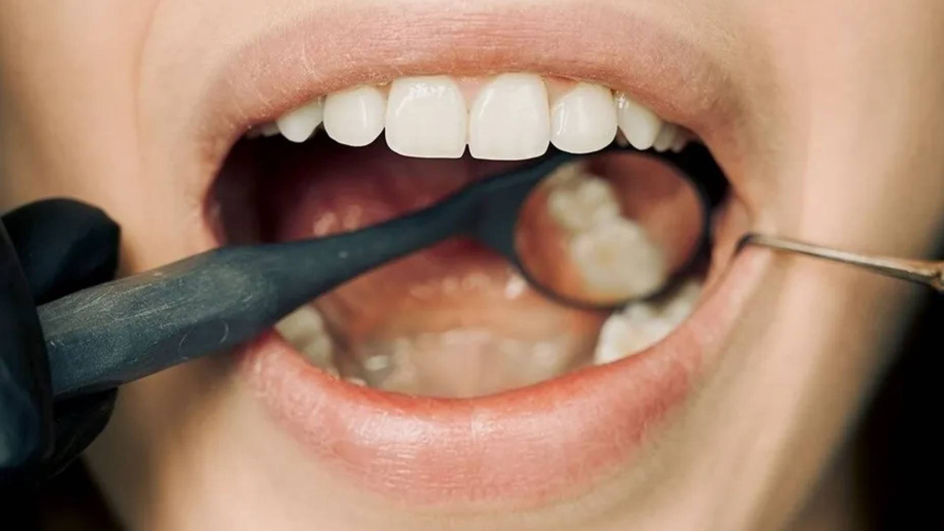 رائحة الفم صباحا.. طبيبة أسنان تكشف 3 أسباب خفية تتجاوز نظافة الأسنان