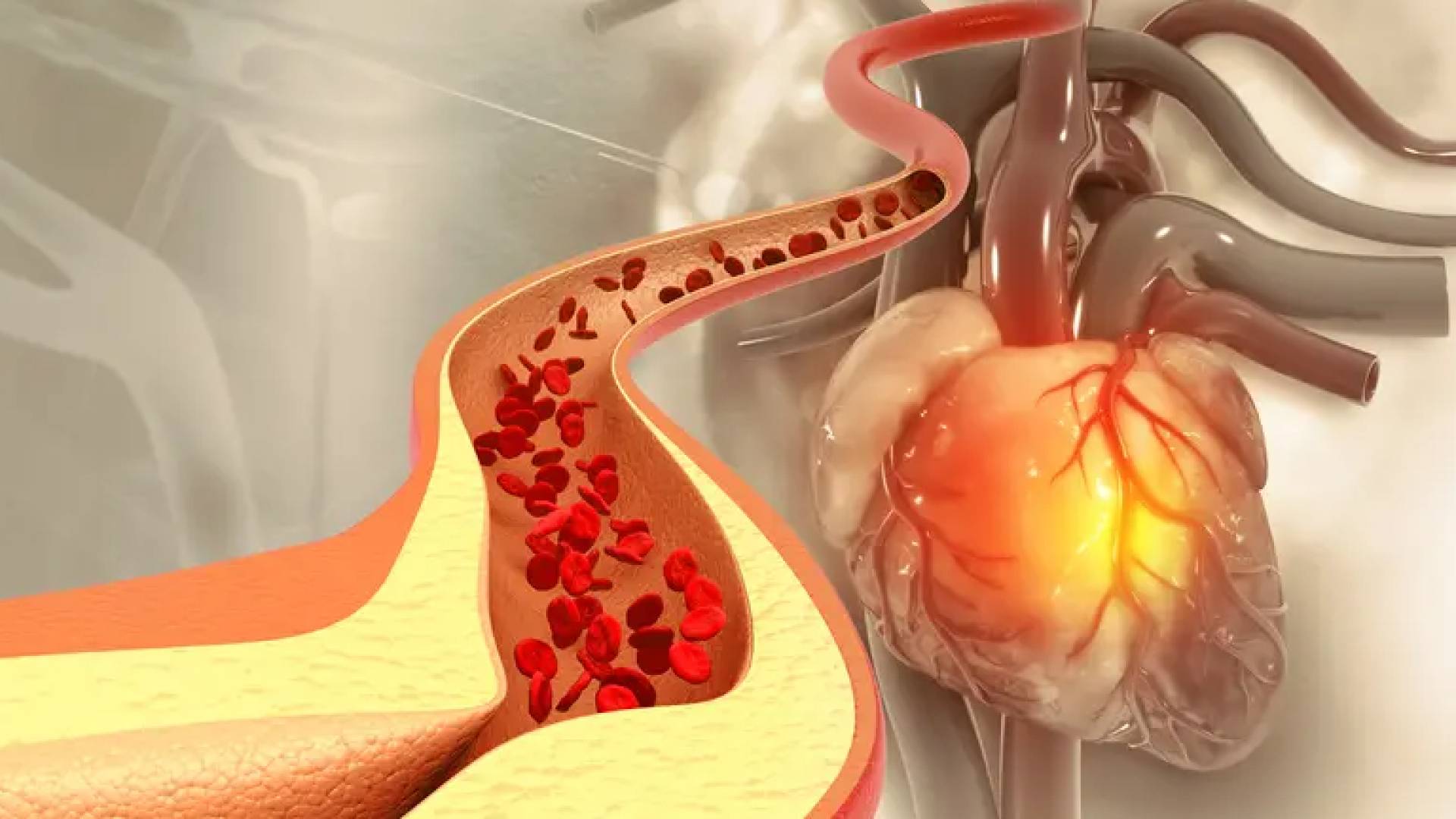 دراسة تكشف: 99% من النوبات القلبية والسكتات الدماغية سببها 4 عوامل فقط
