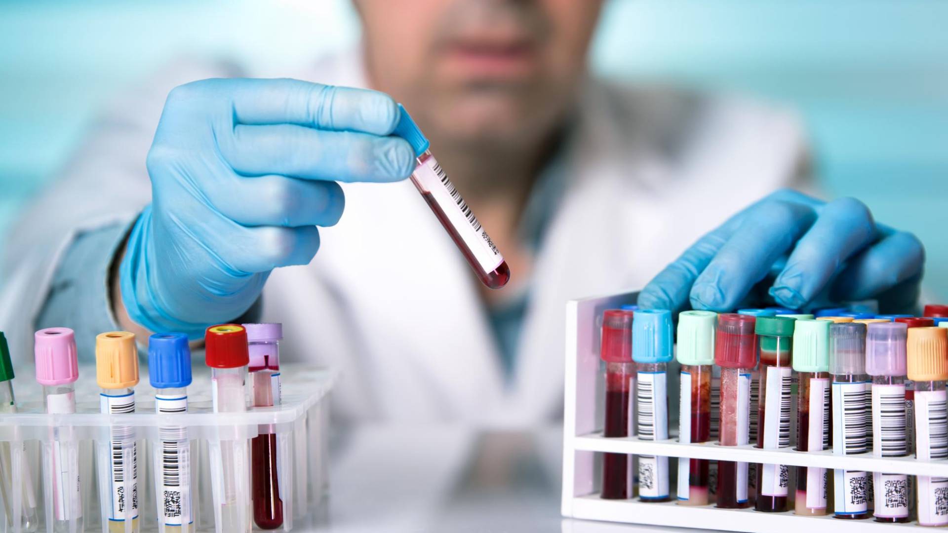 بعد الأربعين.. 4 فحوصات دم مهمة للحفاظ على صحة مثالية