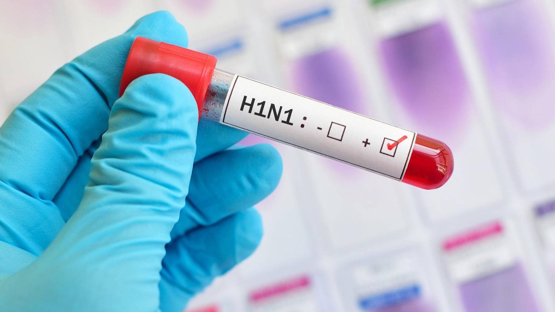 إنفلونزا الخنازير