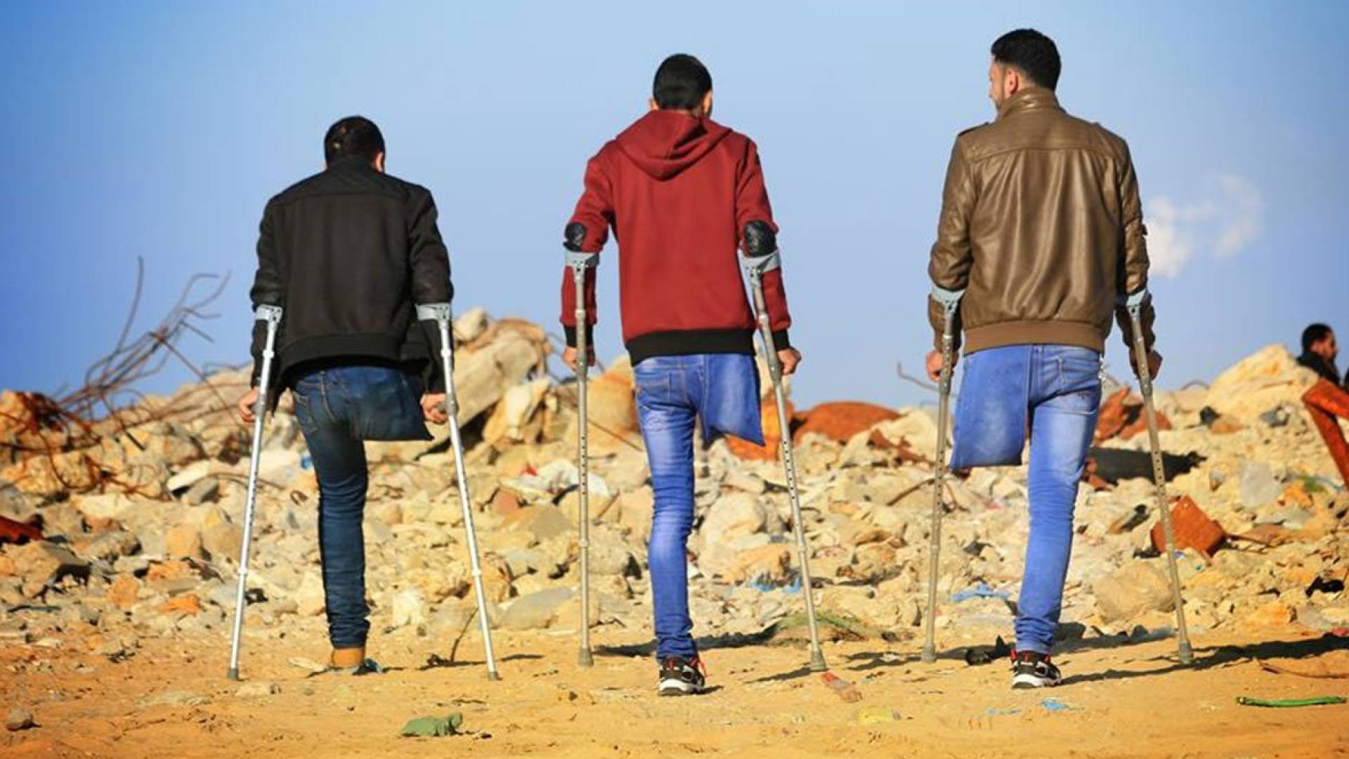 شباب يعانون من بتر في الساق