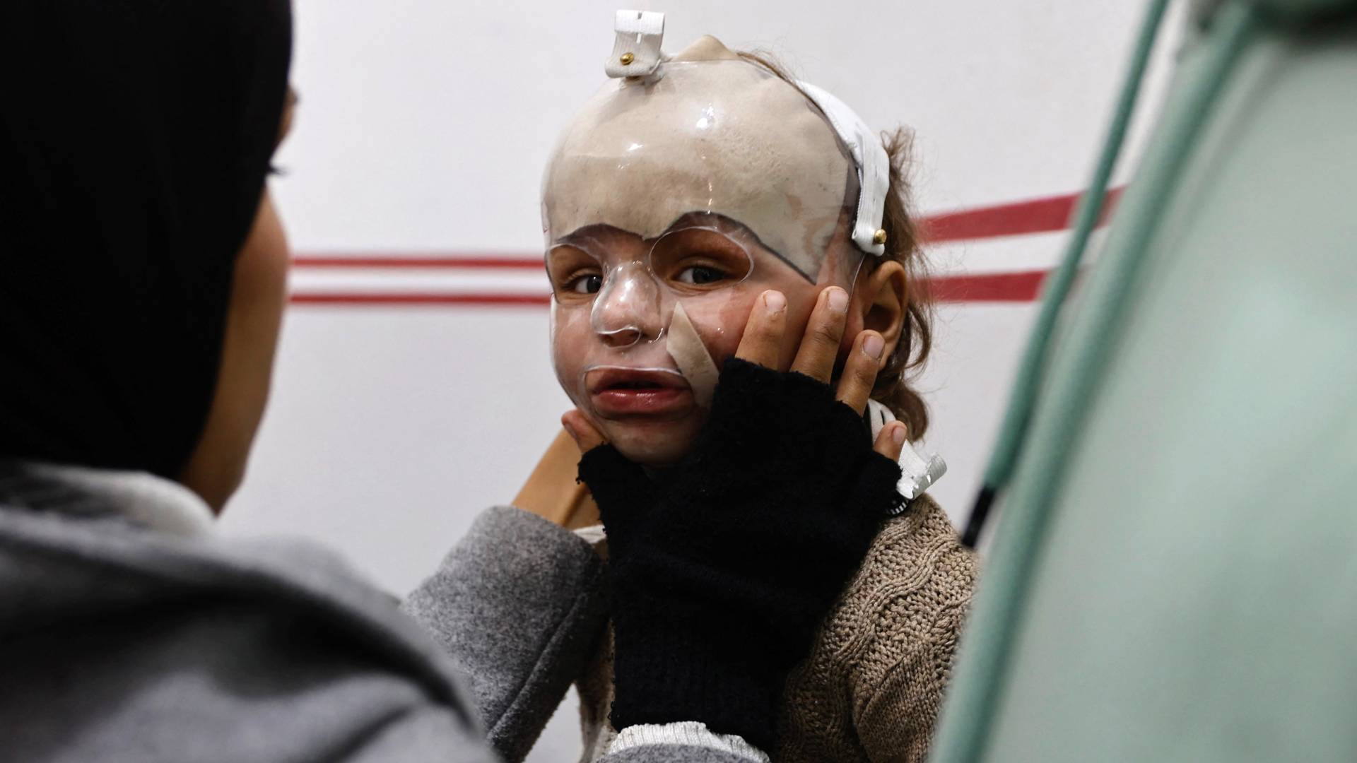 طفلة في غزة بحاجة مساعدة طبية