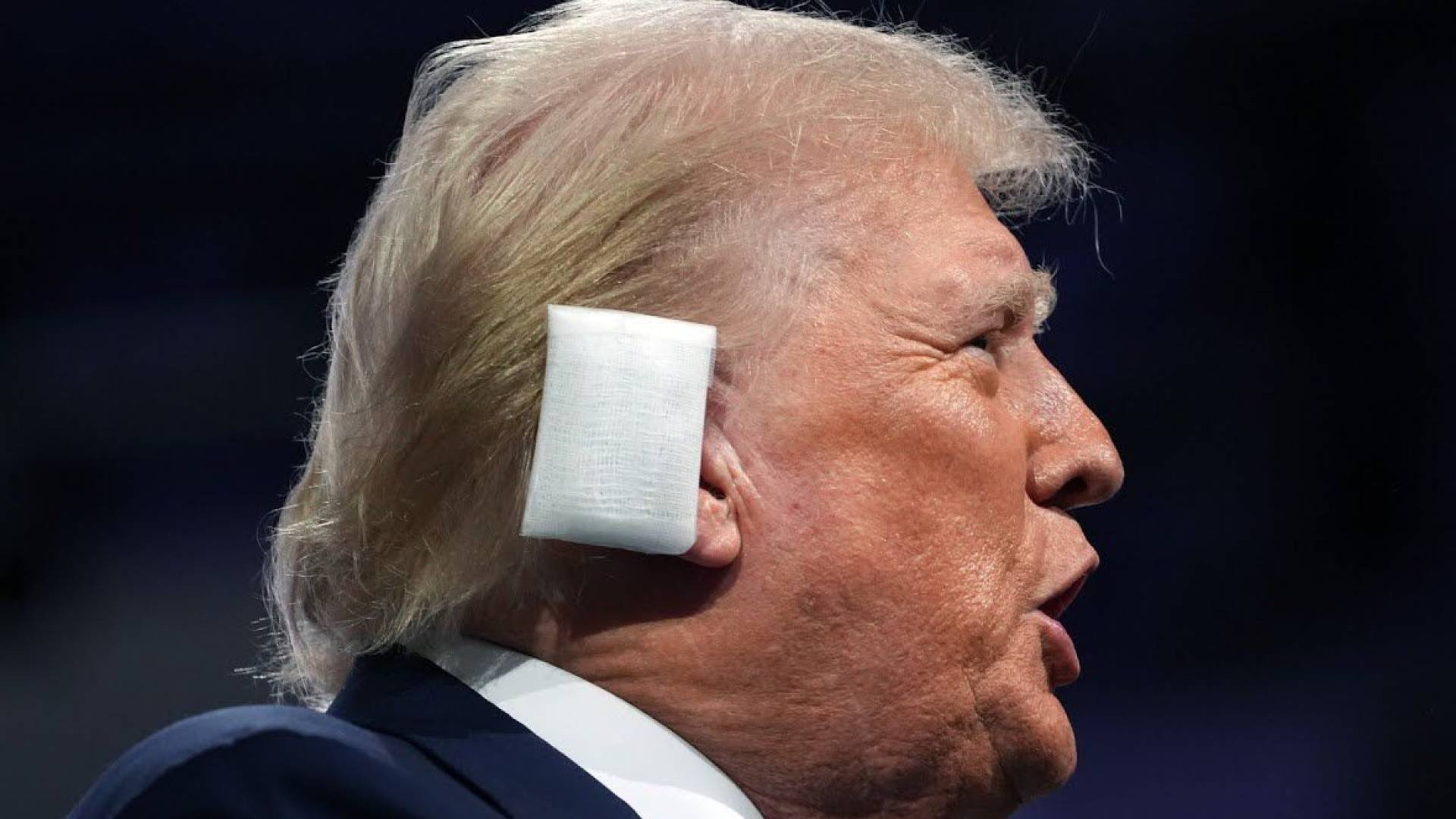 اصابة الرئيس الأمريكي دونالد ترمب