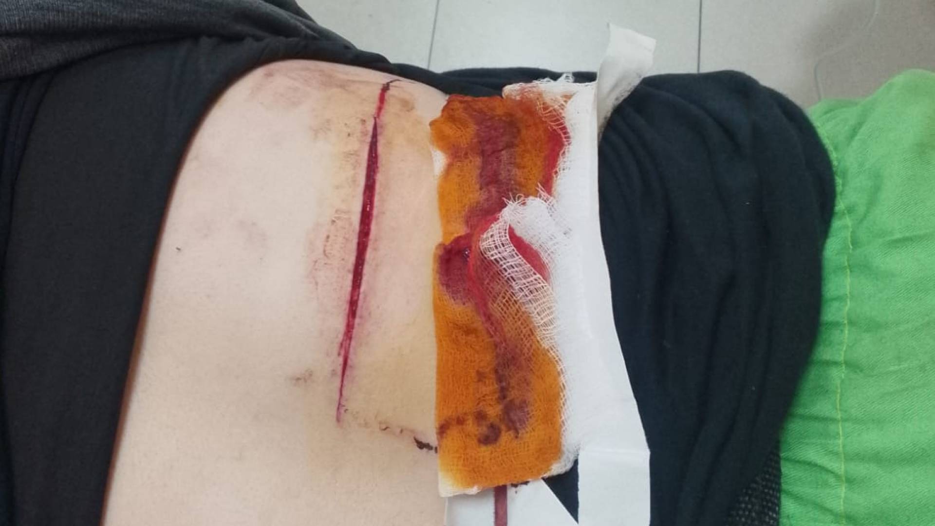 اعتداء على عامل وطن