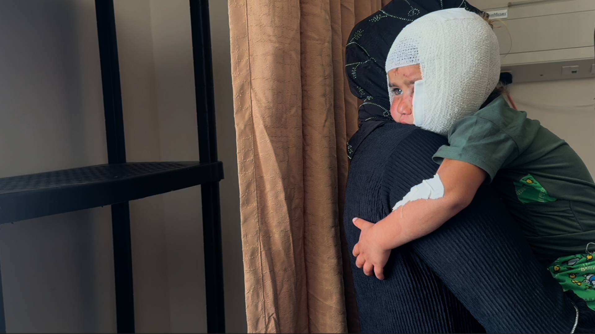 كلب يشوه وجة طفلة