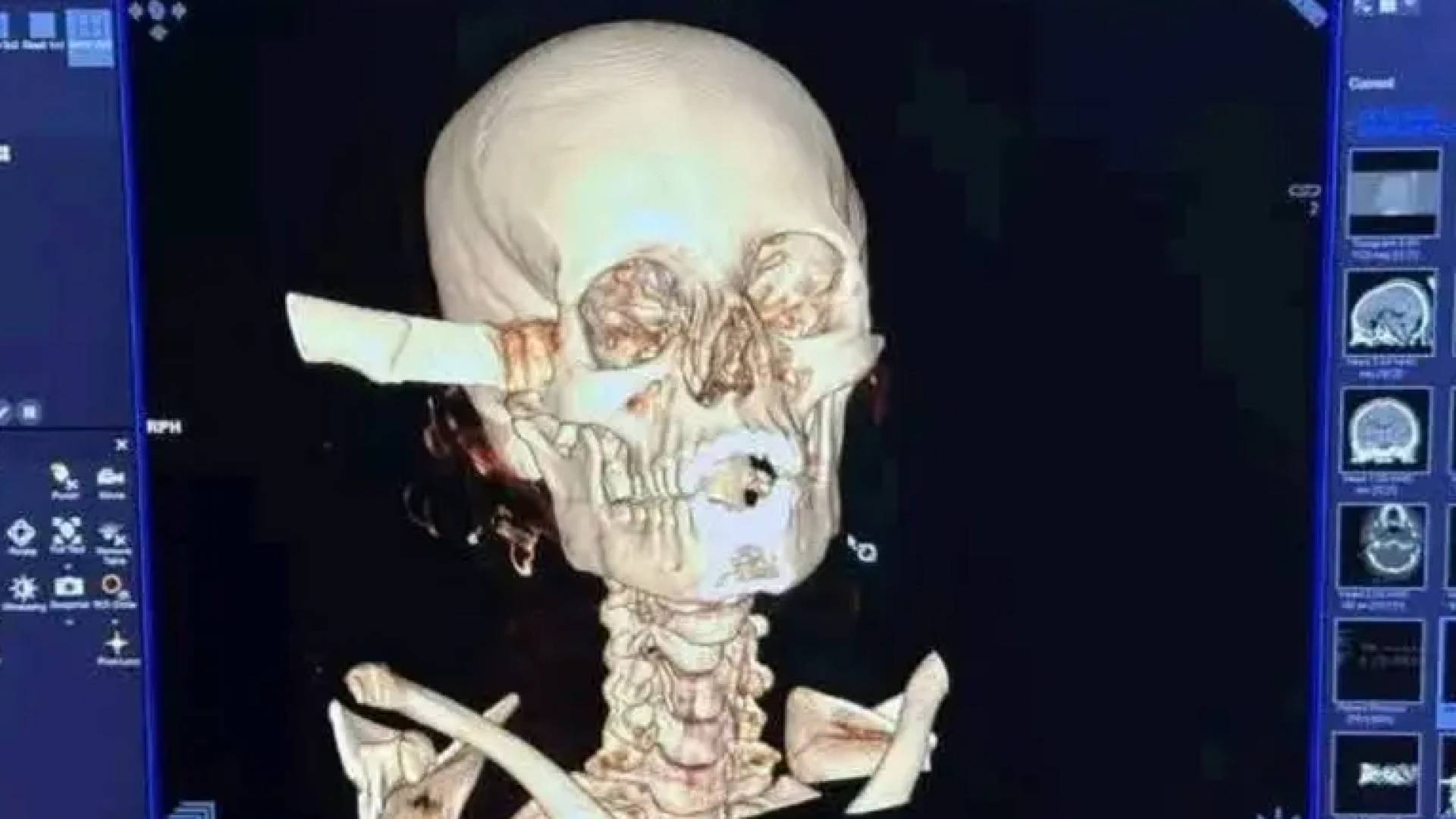 جمجمة