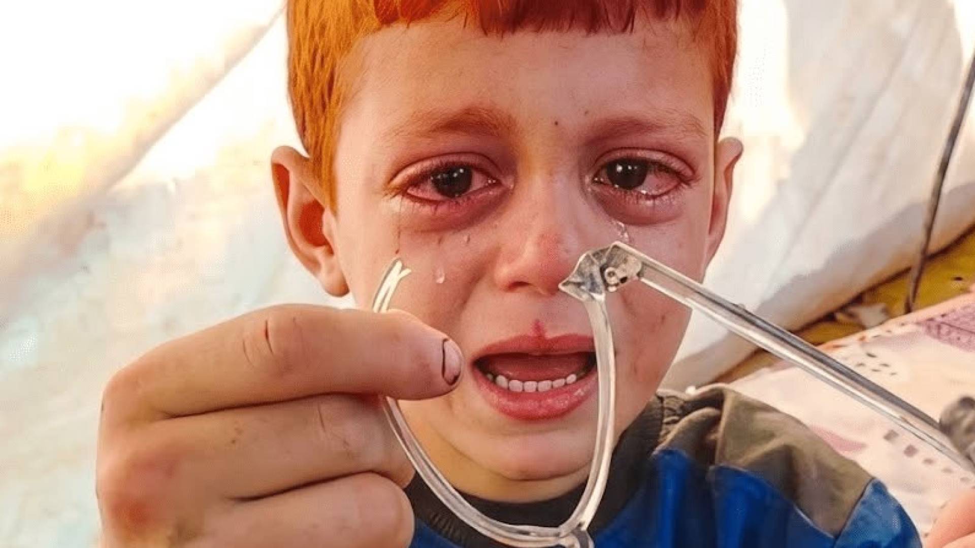الطفل "أيوب "