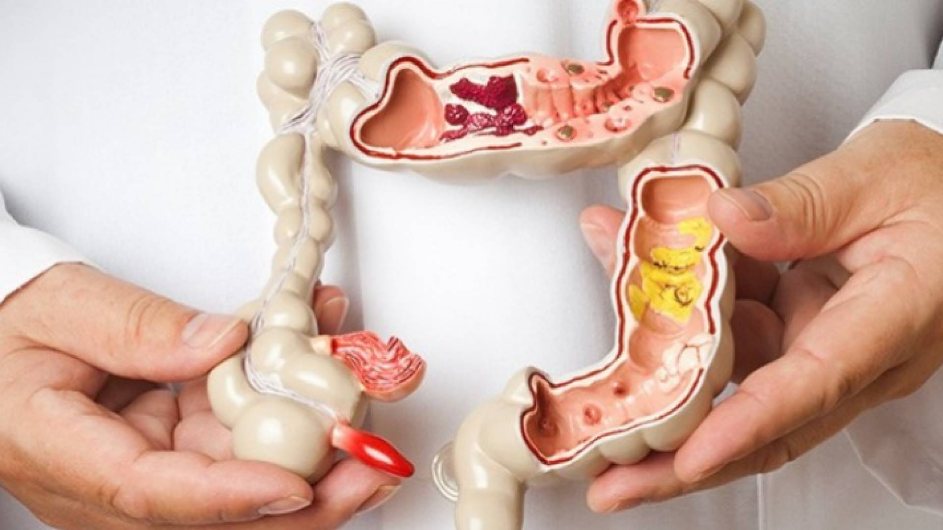 الصورة تعبيرية