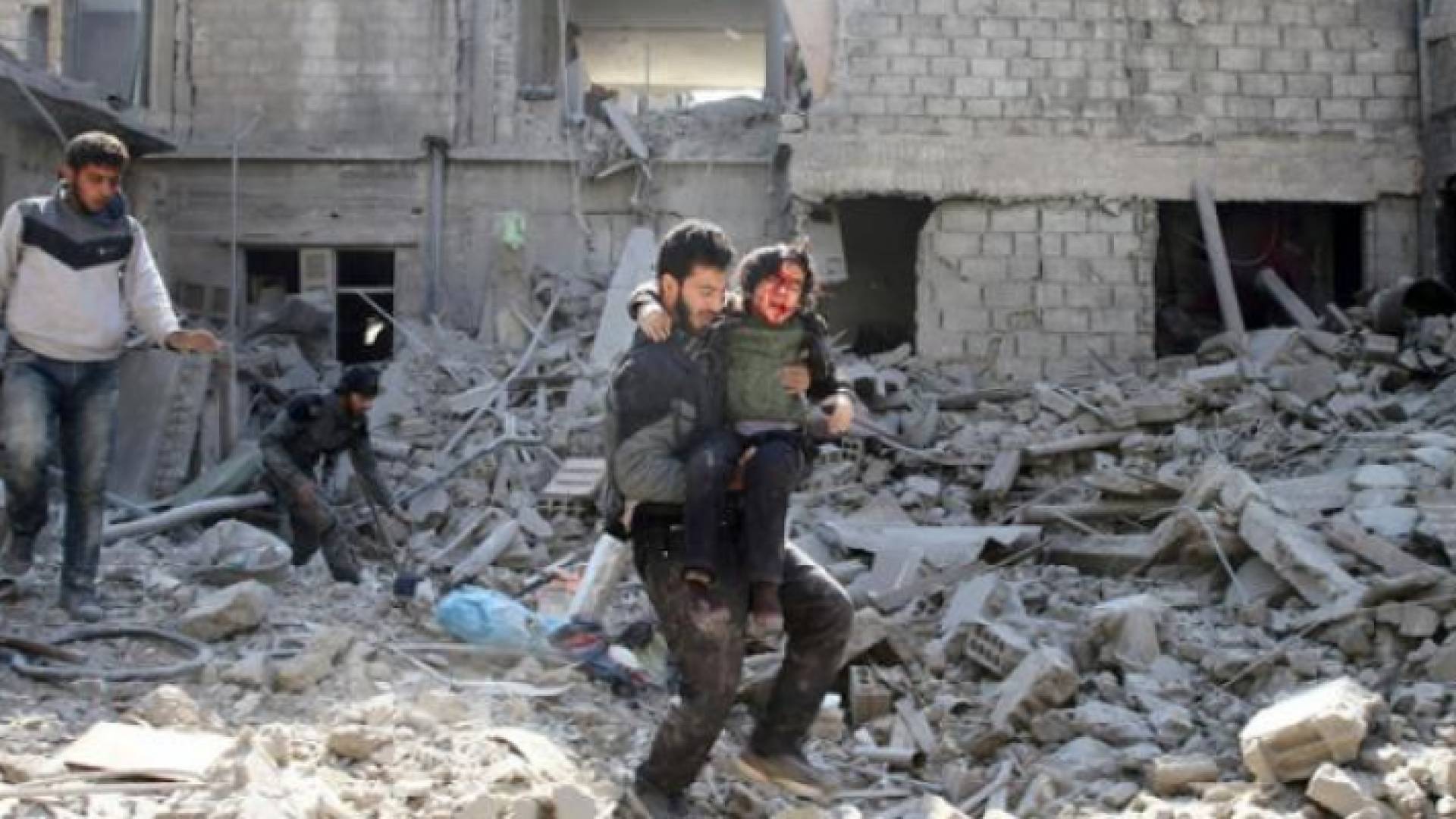 مصابون اثر القصف على الغوطة - ارشيفية