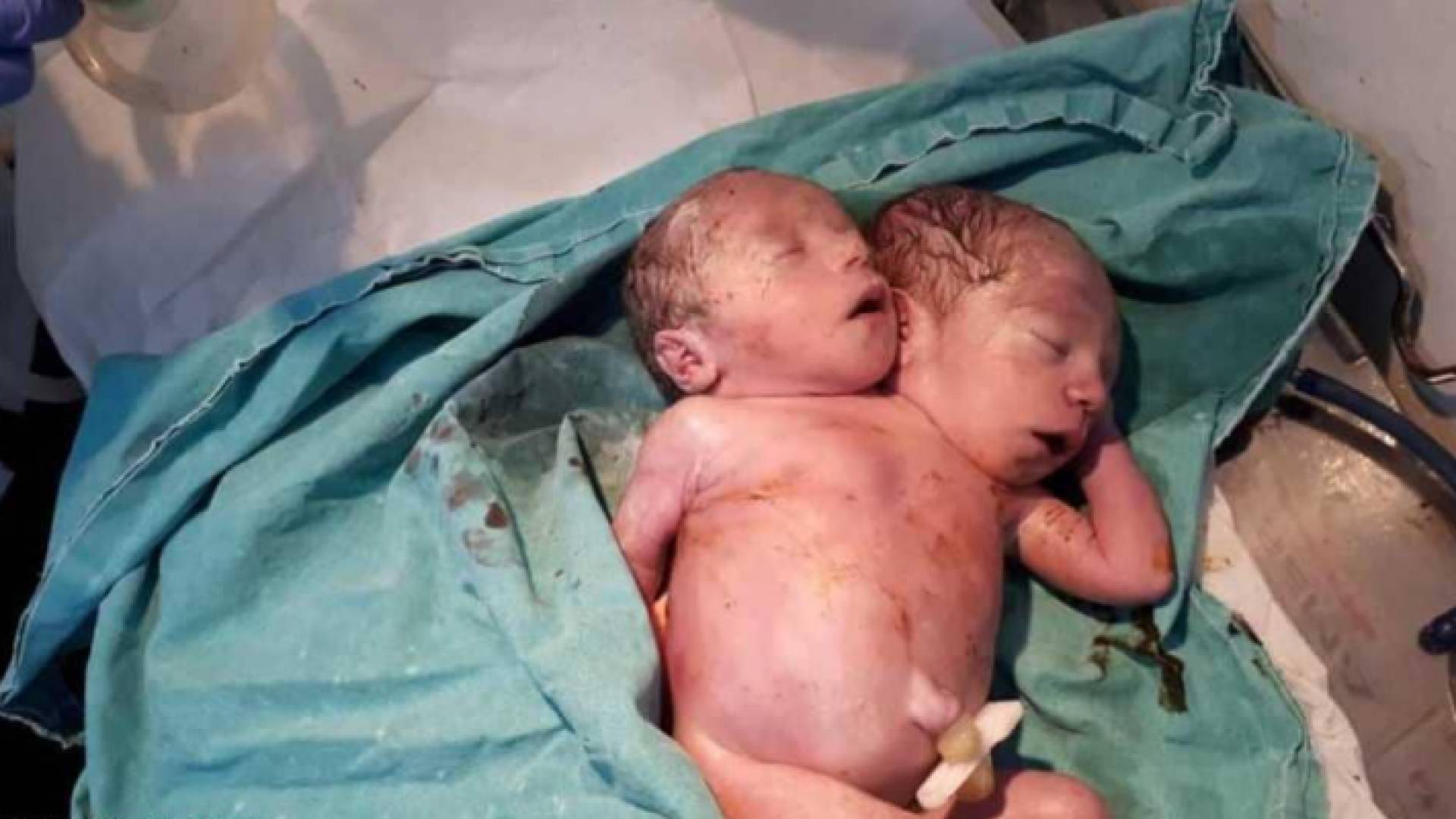 الطفل فارق الحياة بعد ساعات