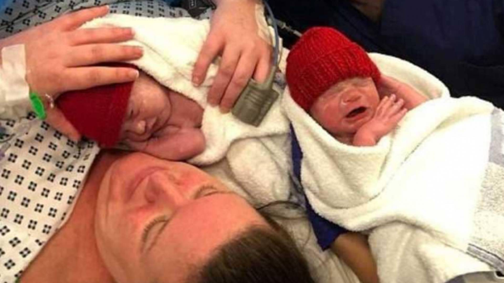 الولادة نادرة وتحدث مرة بين كل 500 مليون سيدة