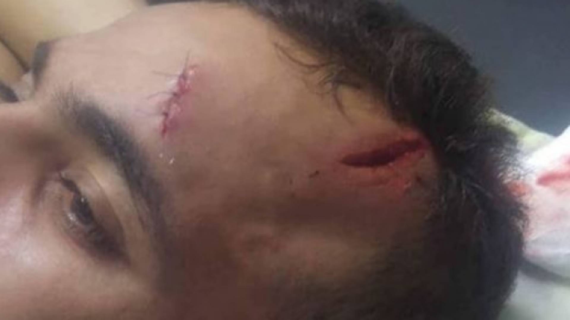 احد الشباب المعتدى عليهم