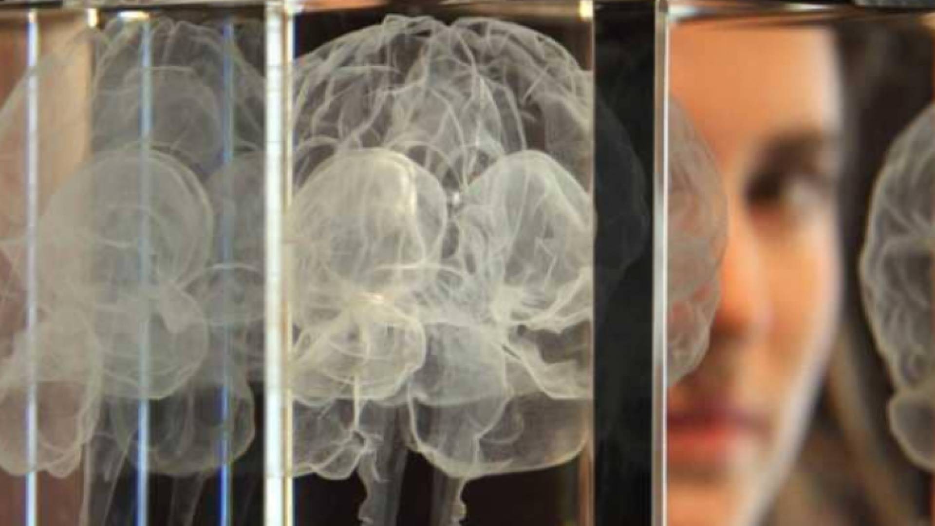 الكذب يحفز نشاطا في الدماغ