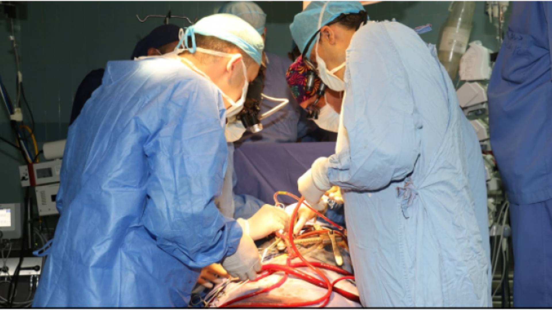 فريق طبي متخصص بمدينة الحسين الطبية أجرى عملية زراعة قلب ناجحة لمريض يبلغ من العمر 27 عاما