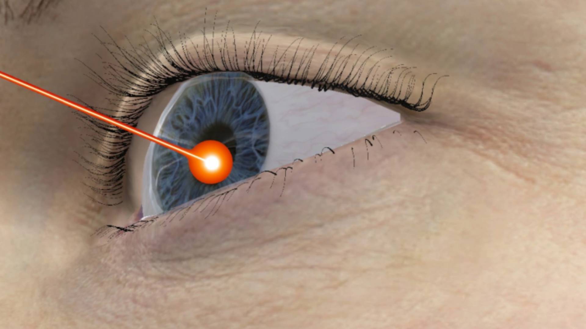 الصورة تعبيرية